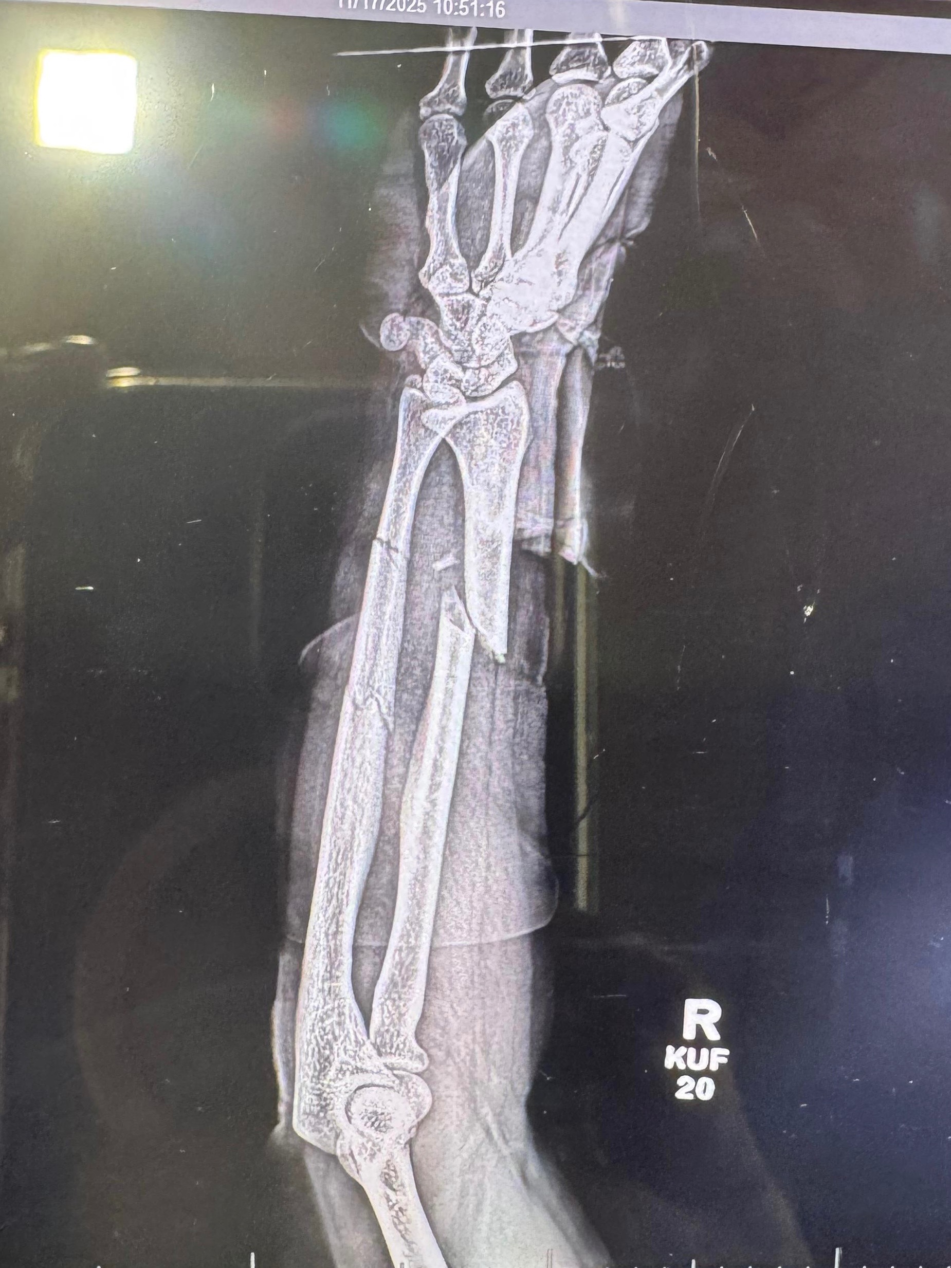 Support Stefany's Recovery from Severe Injuries campaign photo, 2 of 5