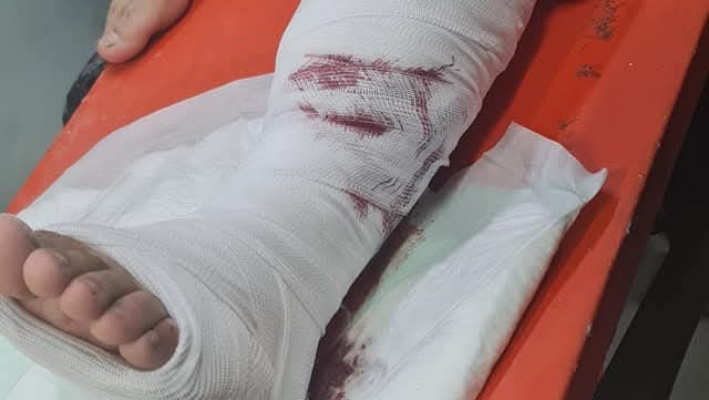 Save a father’s leg from amputation: life under apartheid
