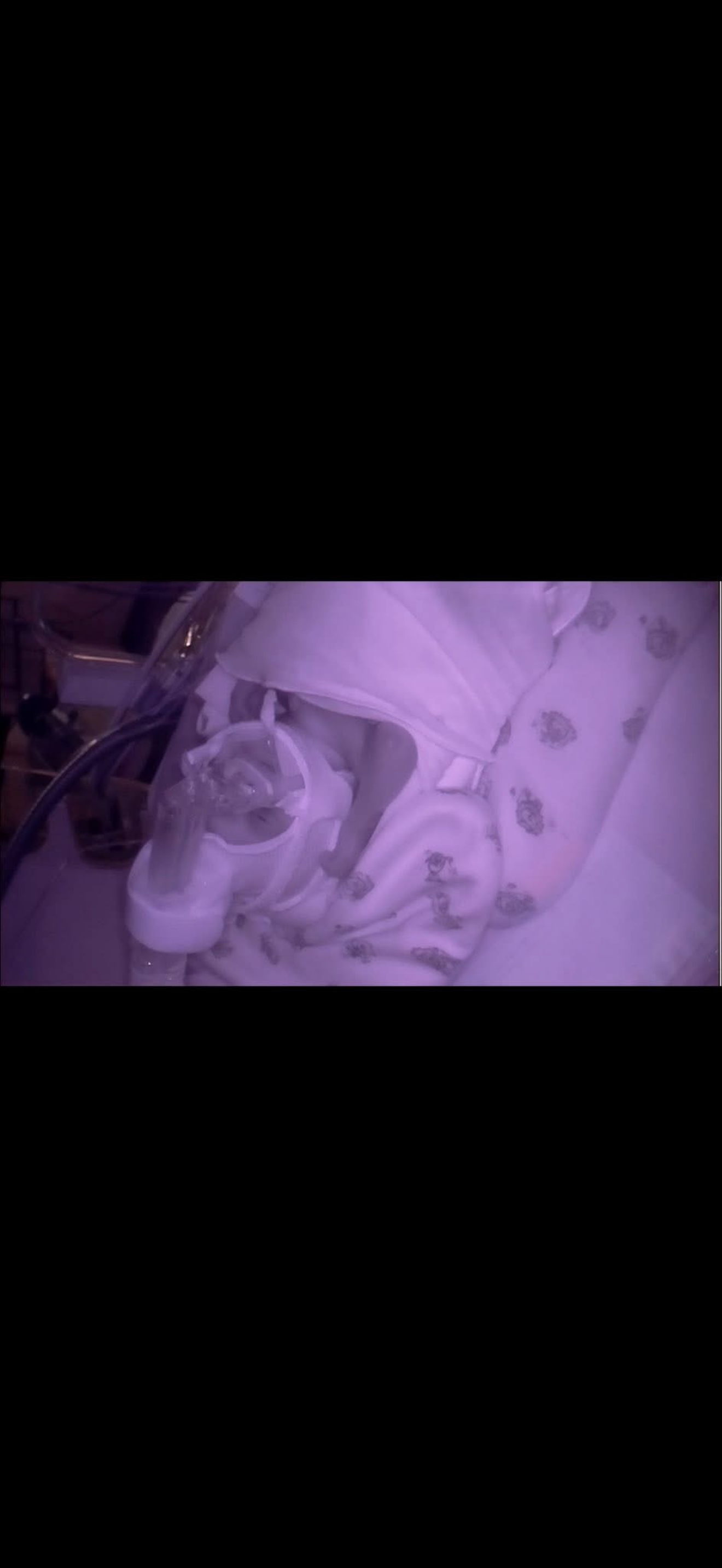 Support Rylee Ann Bresnahan's NICU Journey campaign photo, 4 of 5