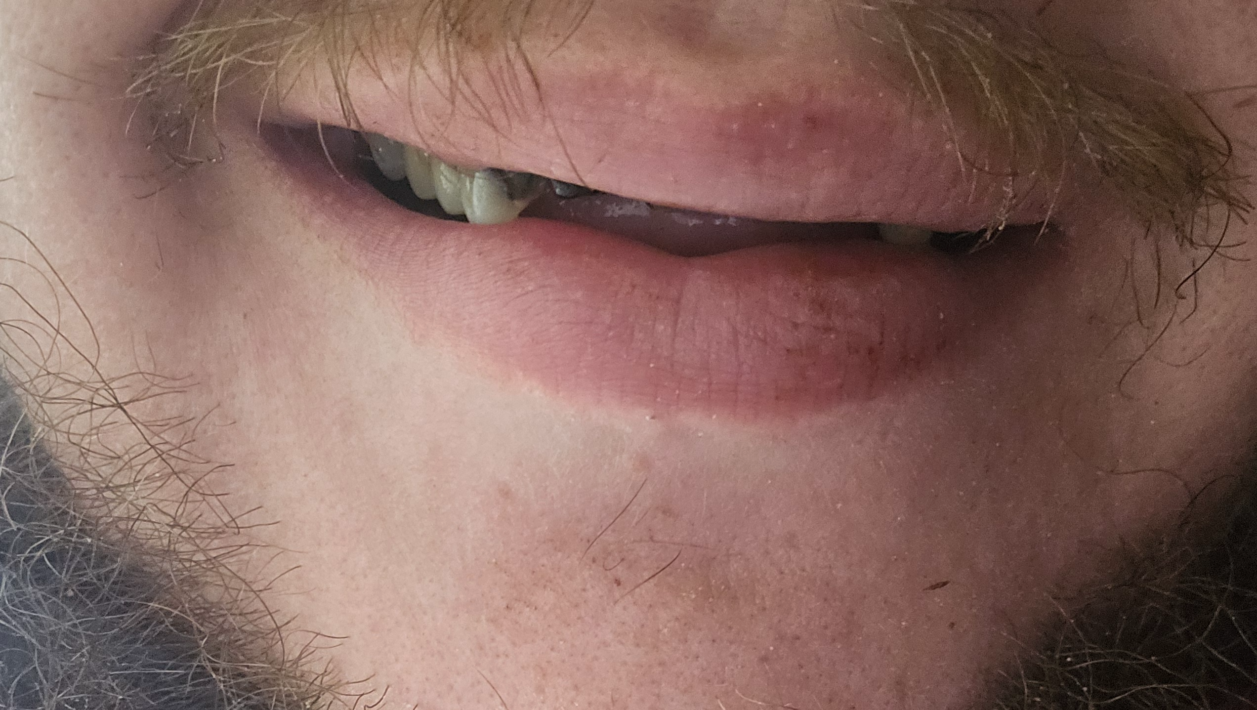Help Transform a Smile After 20 Years photo