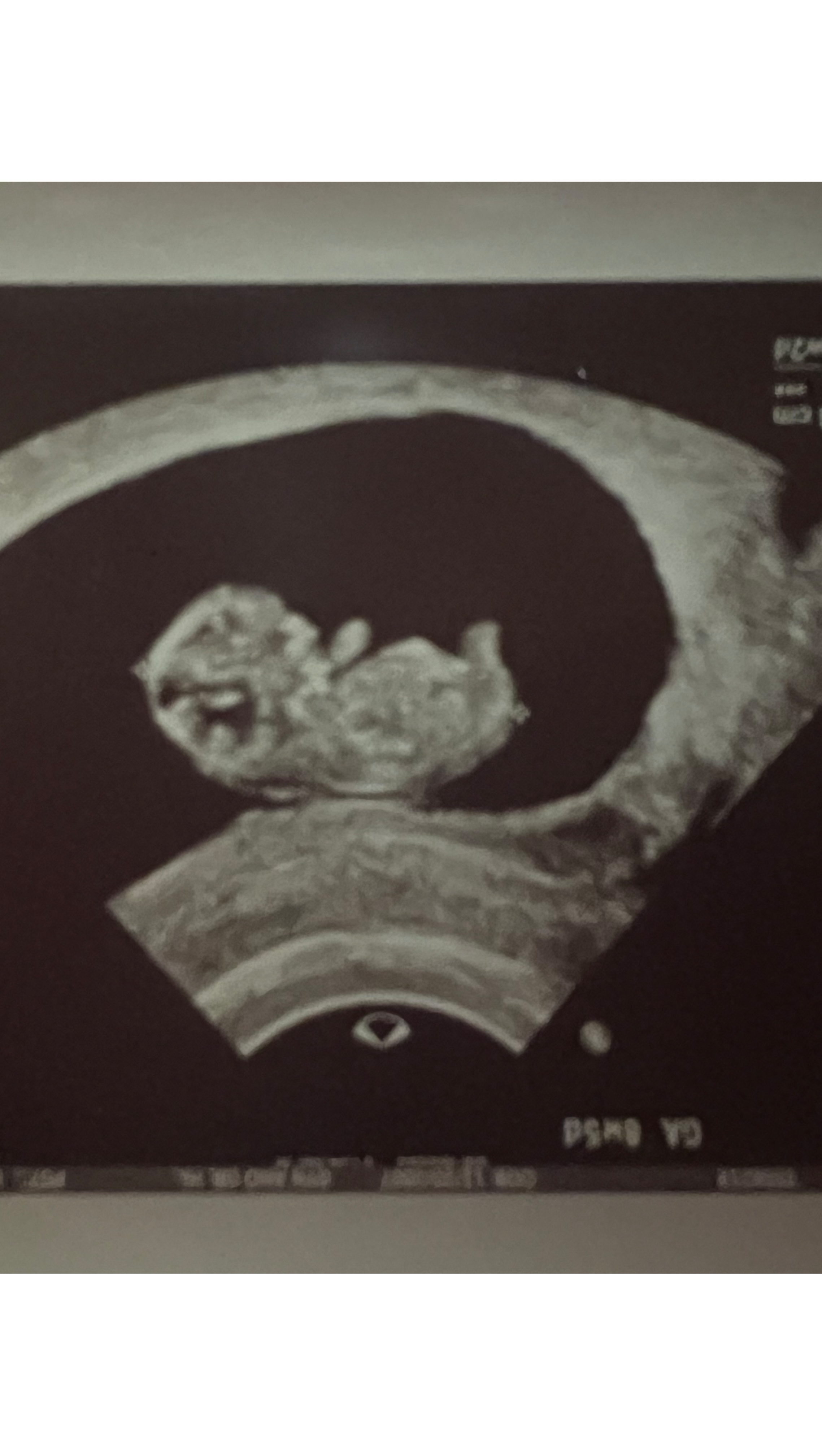 Support Our Growing Family's Journey photo