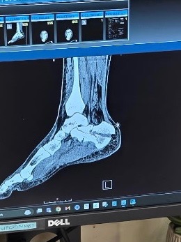 Support Dan Gabbard's Road To Recovery campaign photo, 2 of 6
