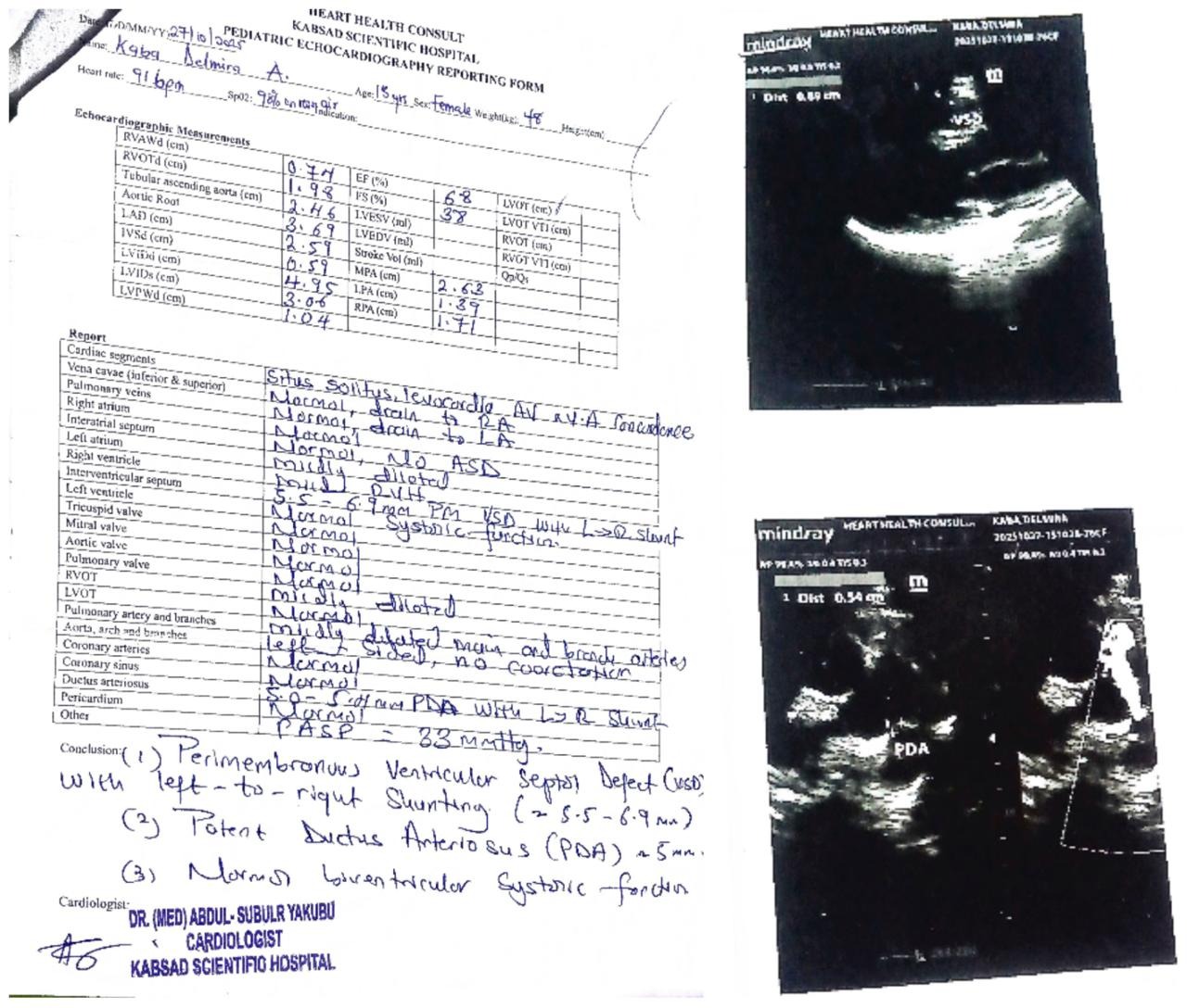 Help our cousin Delmira Get Life-Saving Heart Surgery campaign photo, 6 of 7