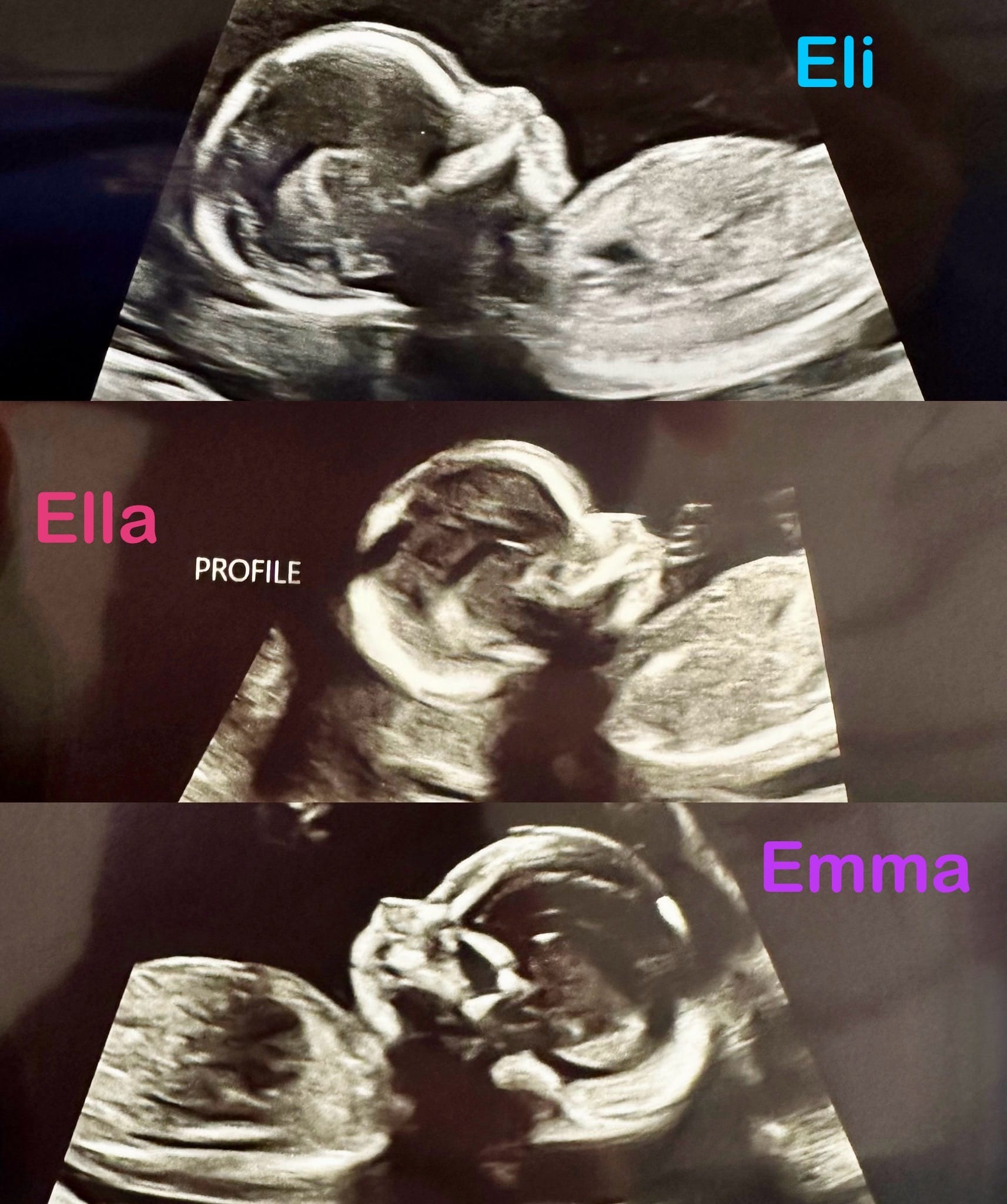 Support Kirstin & Jacob’s Triplets’ Journey campaign photo, 2 of 6