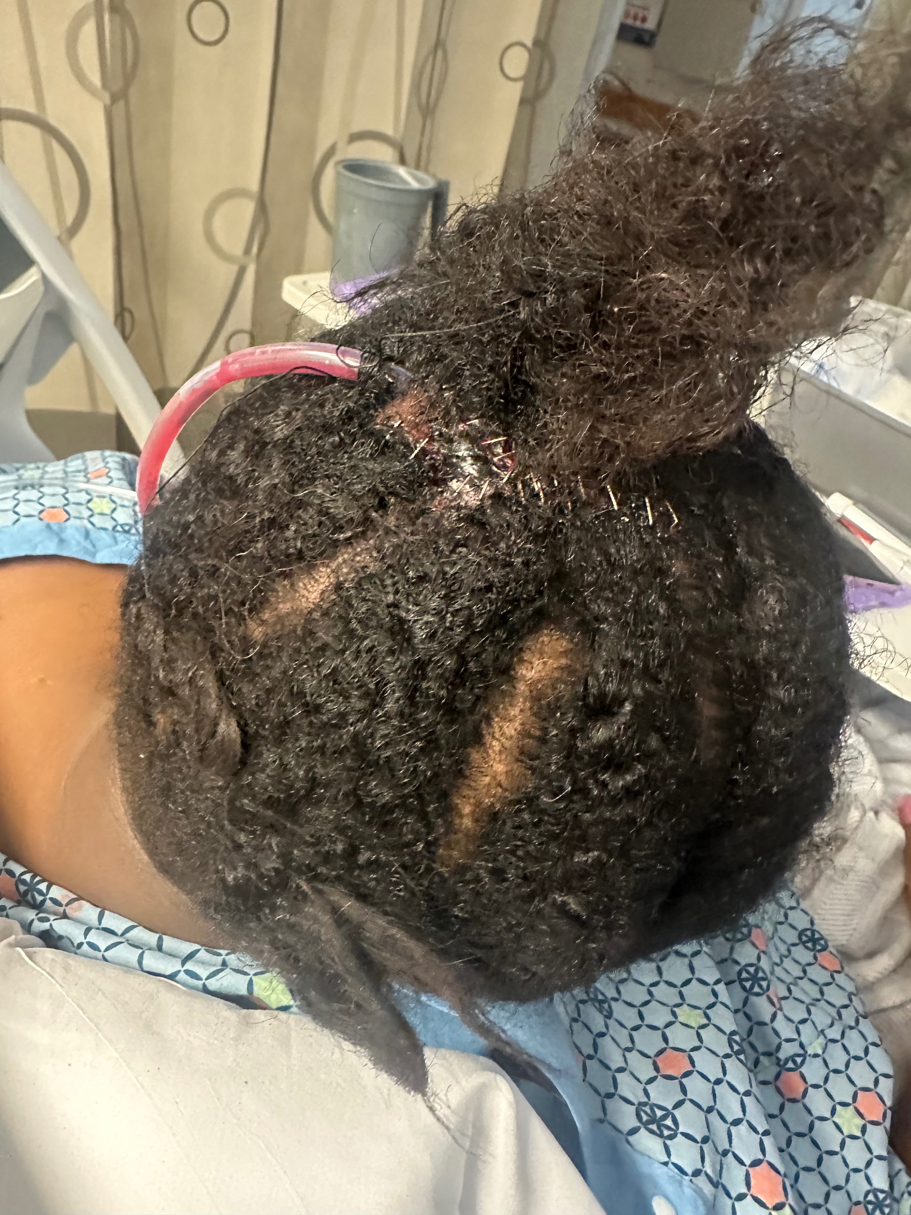 Support Shakimya’s Recovery After Accident campaign photo, 5 of 7