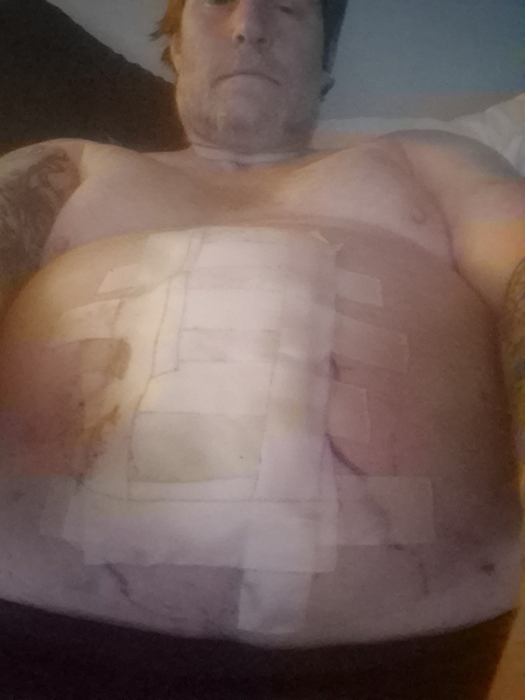 Aid Cliff in Overcoming Surgery Setbacks campaign photo, 6 of 7