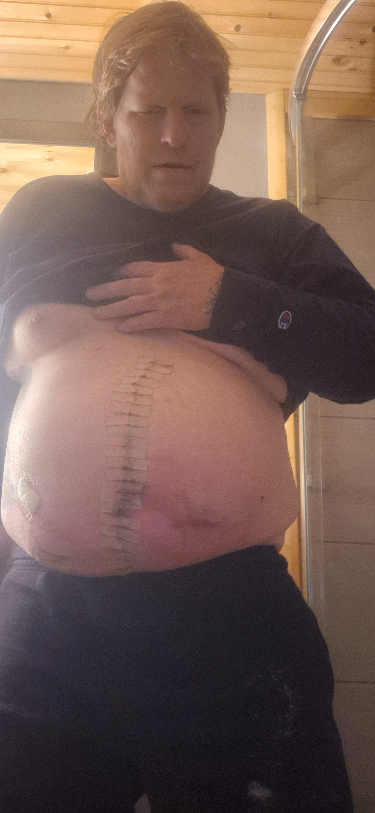 Aid Cliff in Overcoming Surgery Setbacks campaign photo, 4 of 7