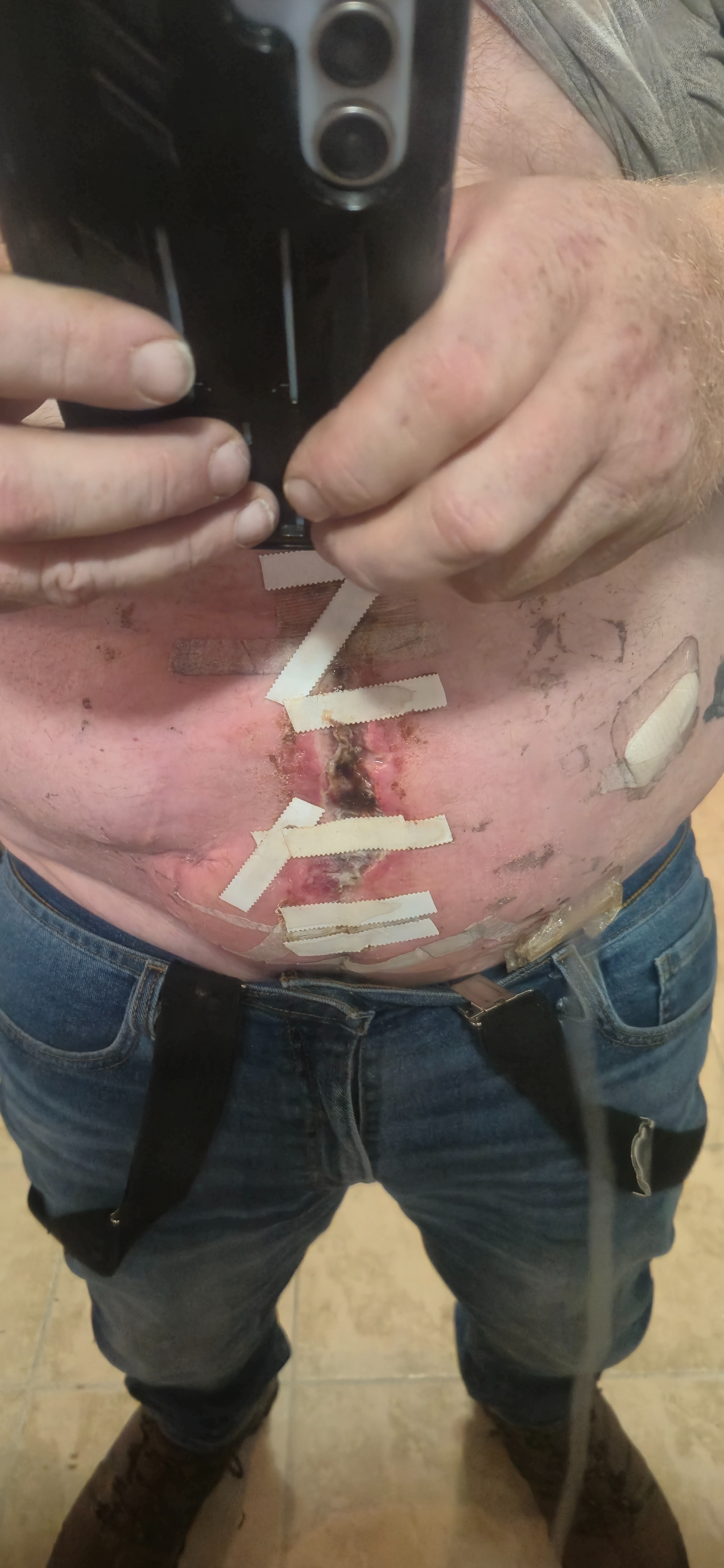 Aid Cliff in Overcoming Surgery Setbacks campaign photo, 5 of 7
