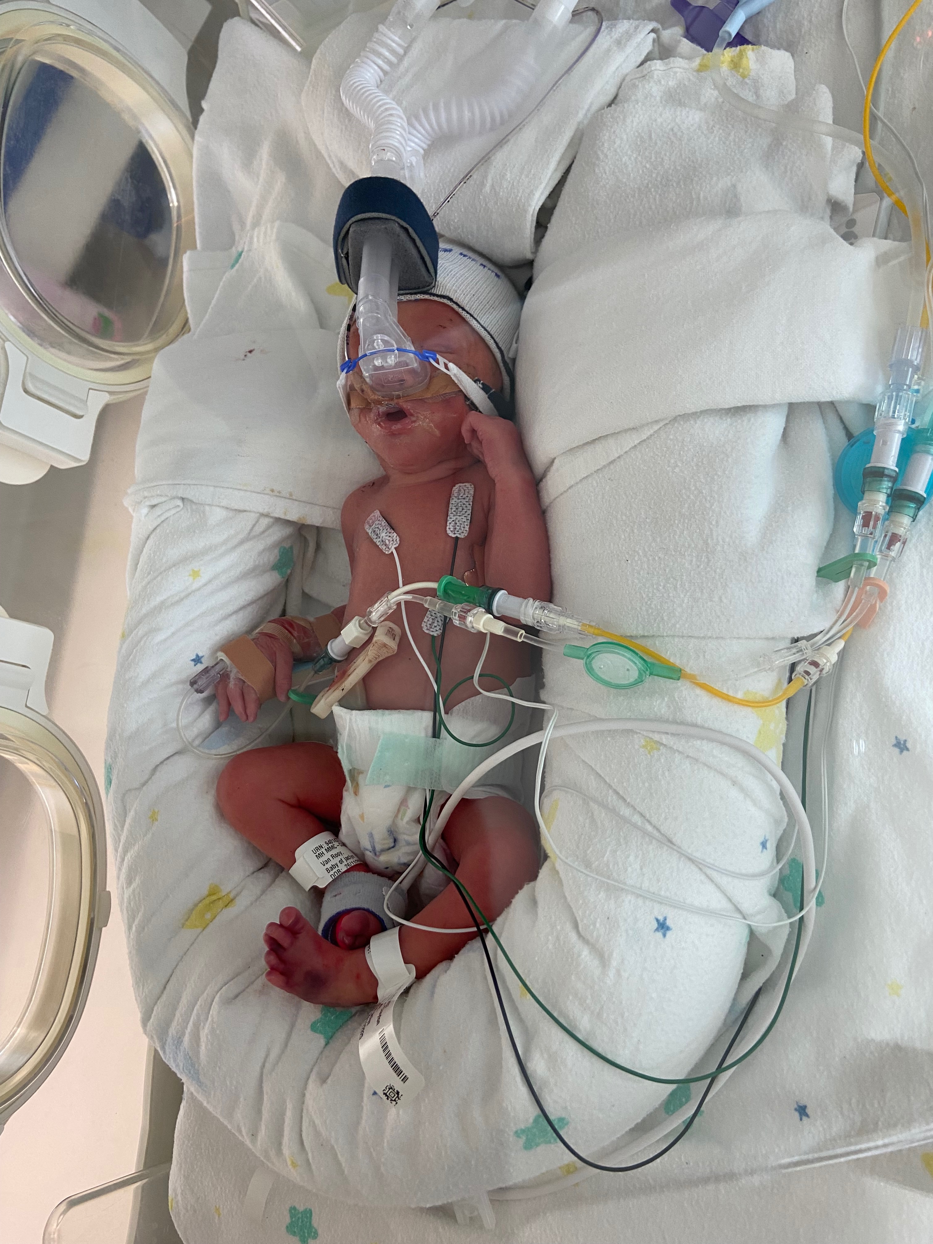 Help support Blake, Jackie and Loni’s NICU journey campaign photo, 5 of 8