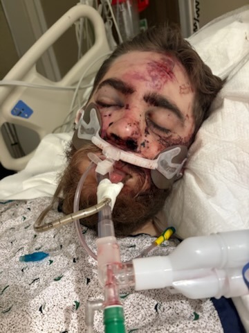 Help Brandon Recover From Motorcycle Accident campaign photo, 2 of 7