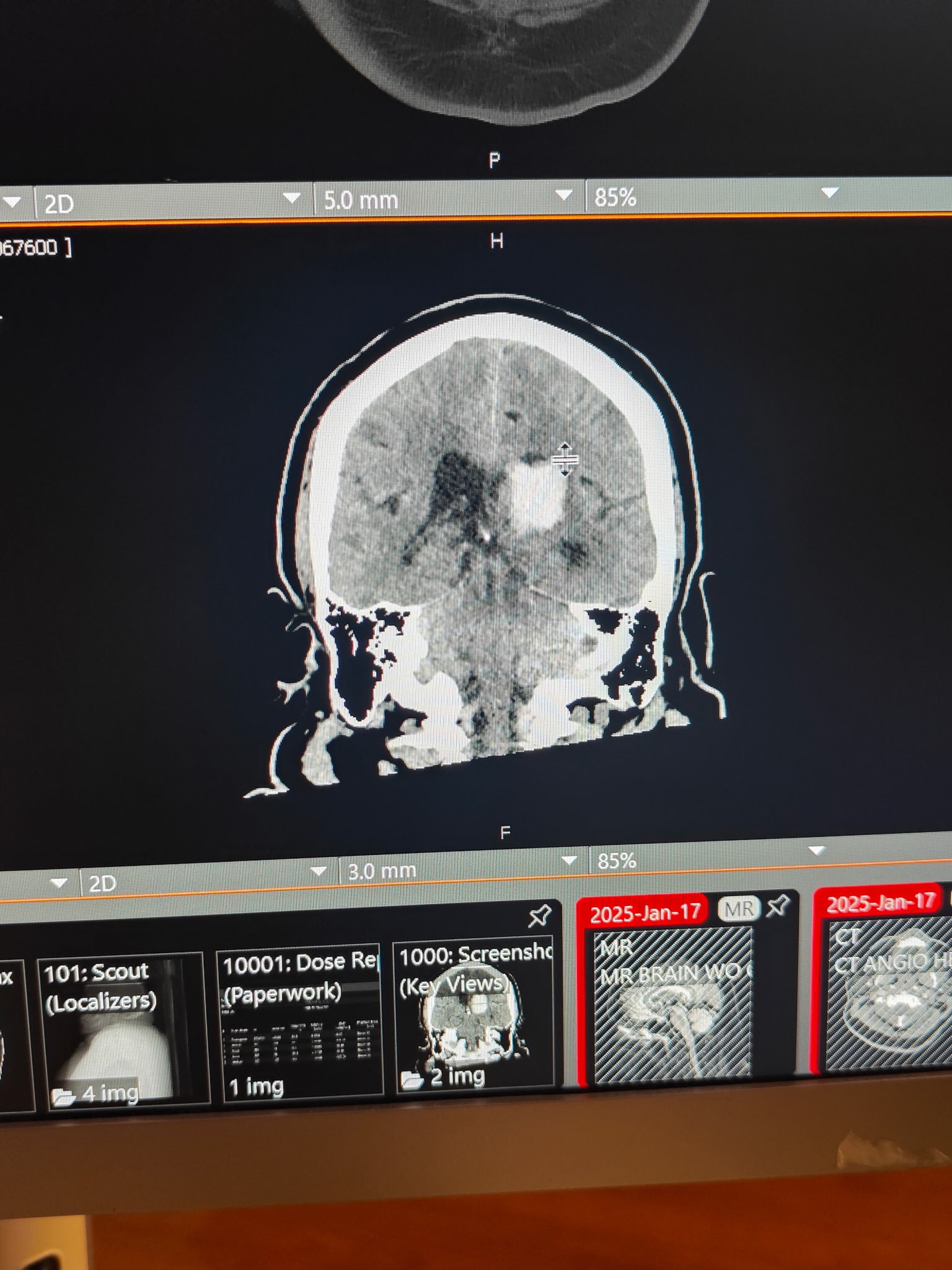 Support David DeMaegd's Stroke Recovery campaign photo, 2 of 5