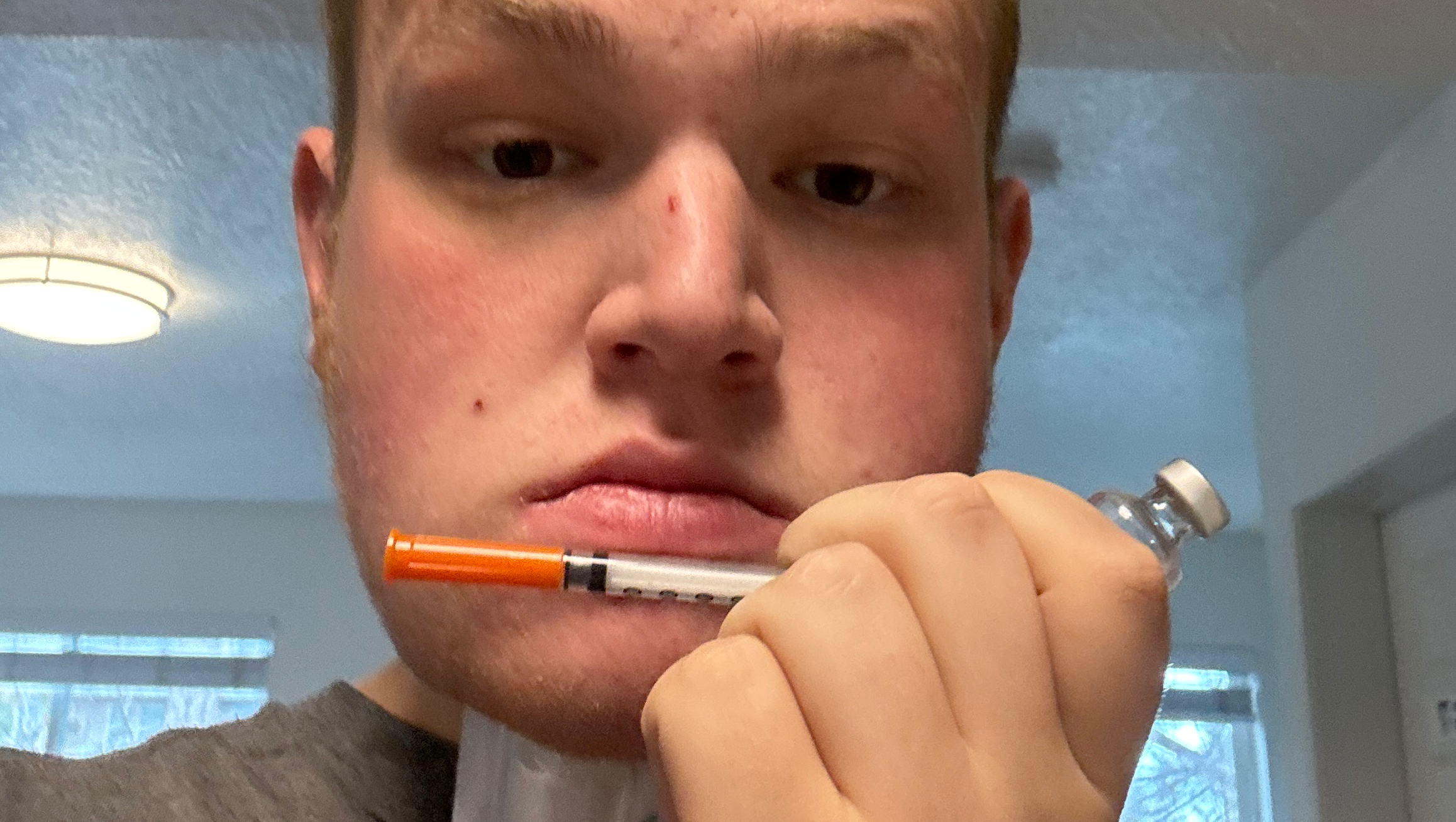 Michaels Diabetic Journey (T1D) photo