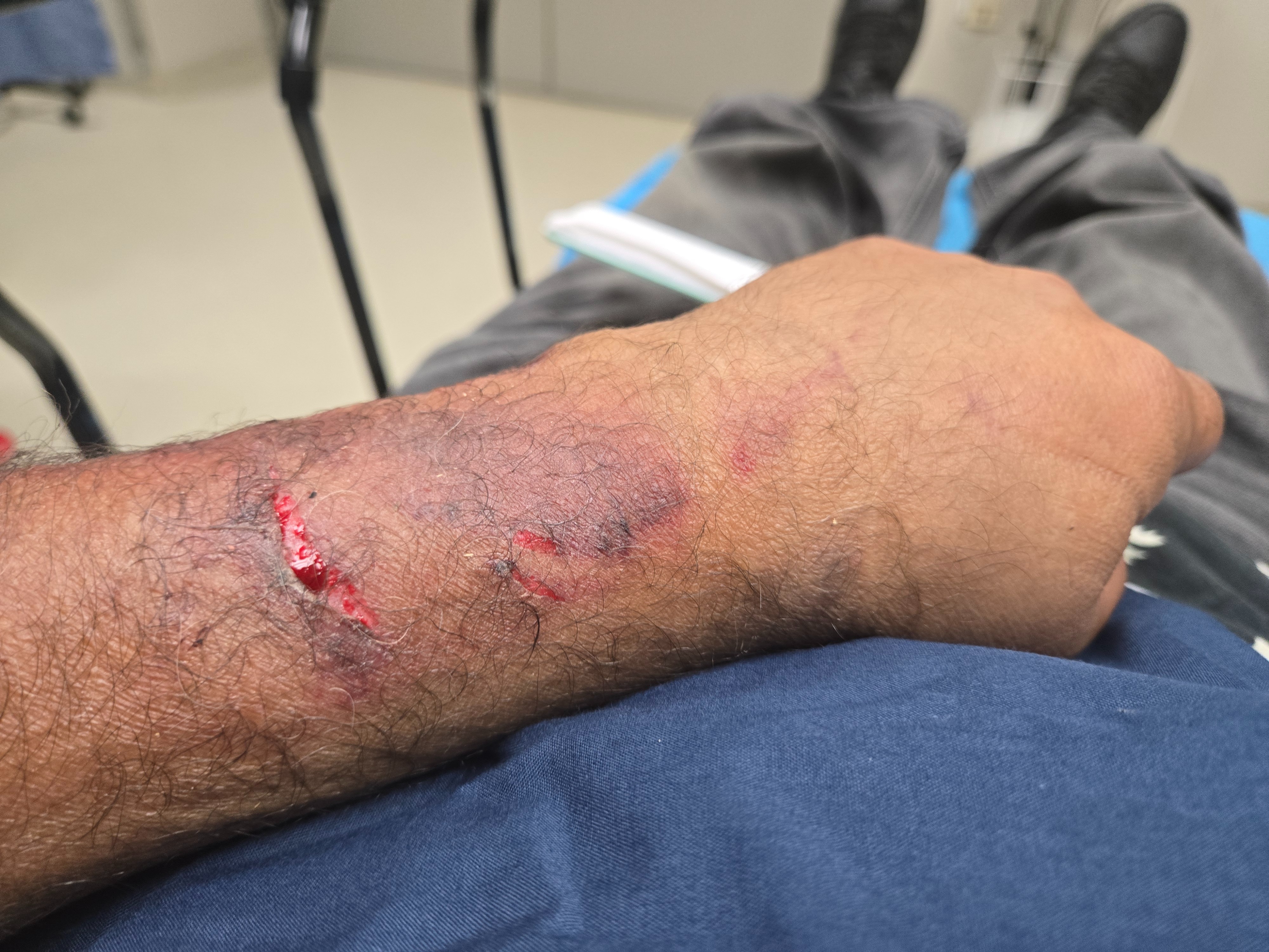 Help a Pulse Nightclub Survivor Recover from Car Accident campaign photo, 2 of 8