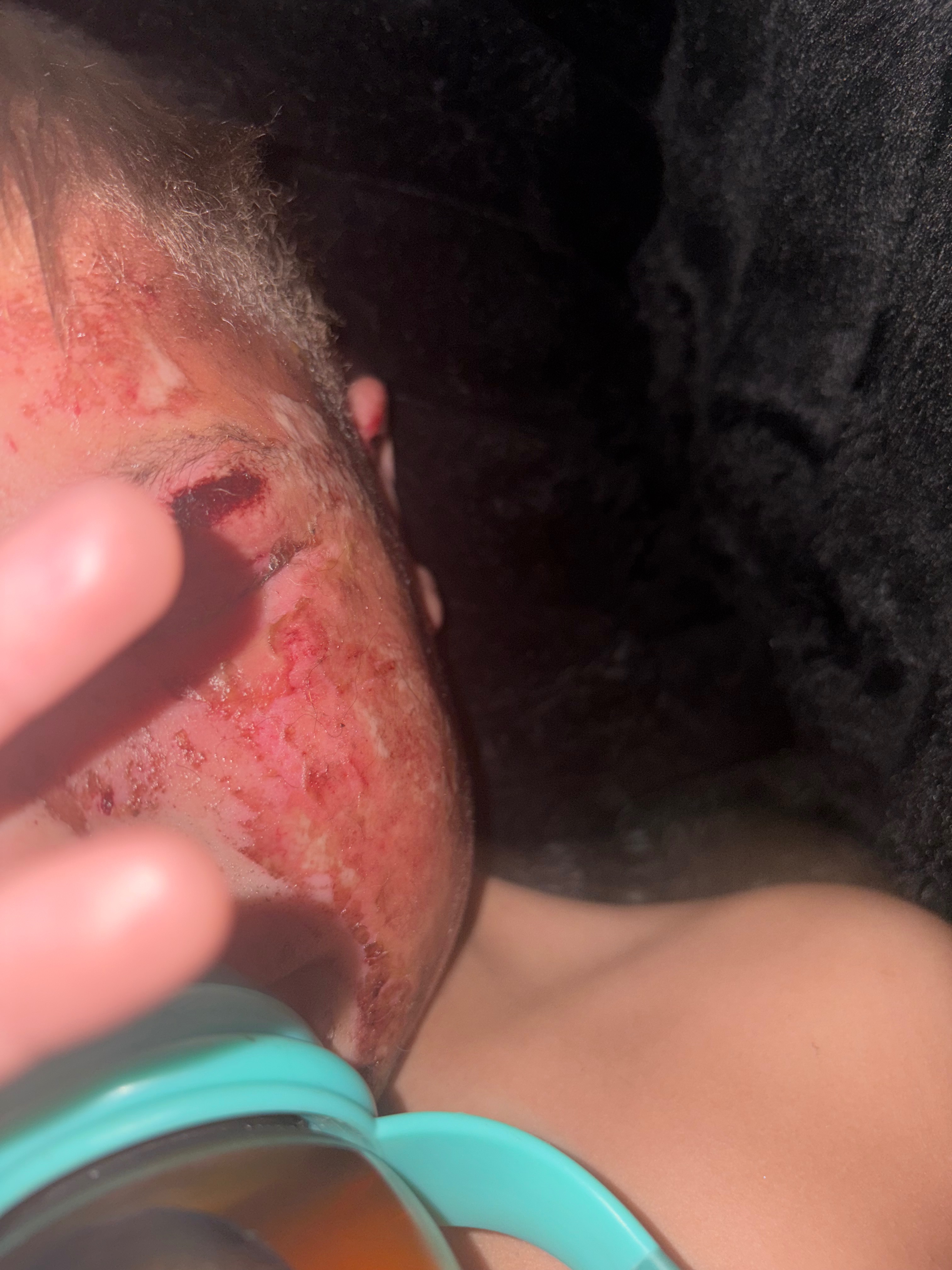 Help Amy & Valor Recover After Accident campaign photo, 5 of 8