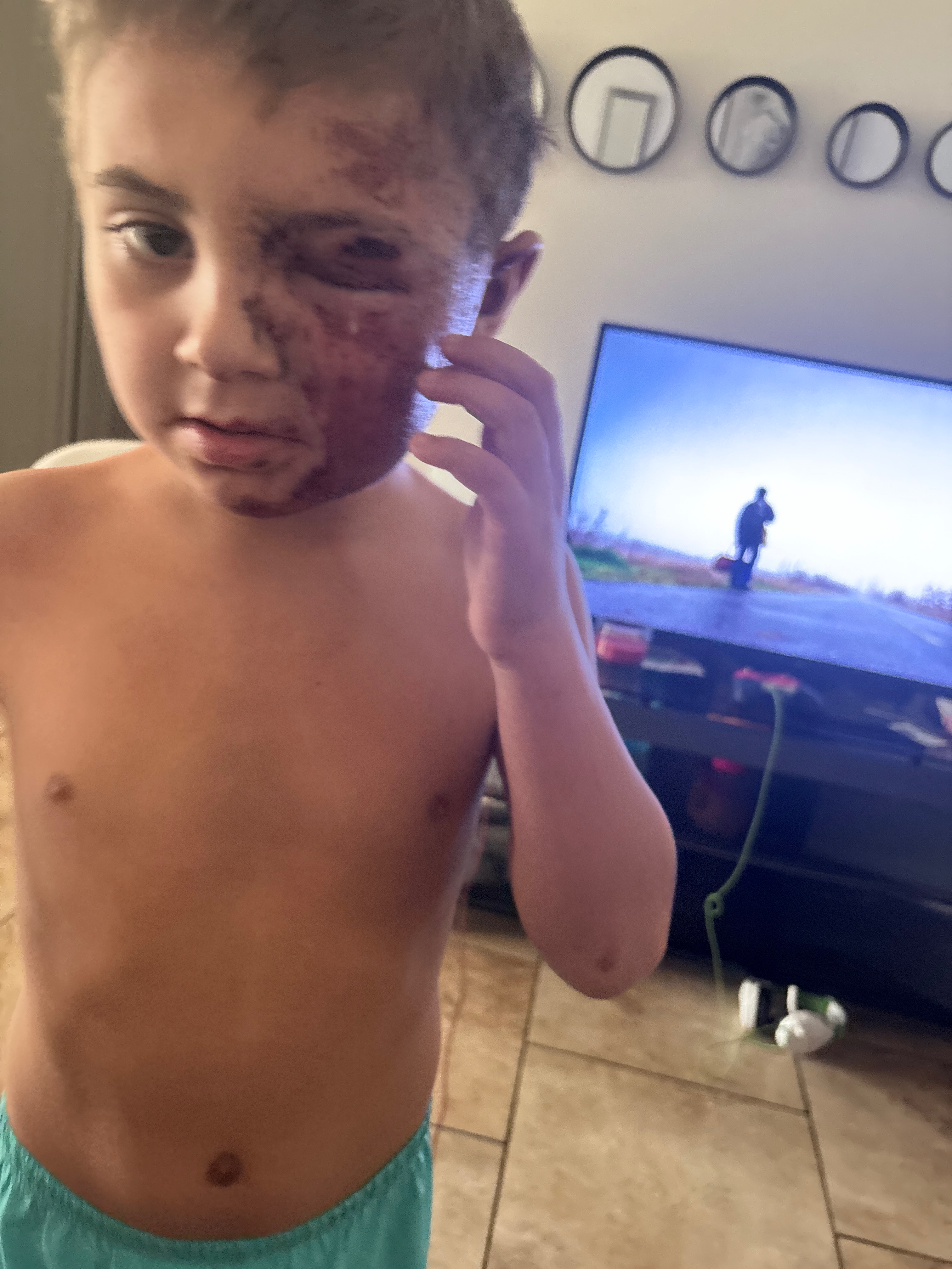 Help Amy & Valor Recover After Accident campaign photo, 6 of 8