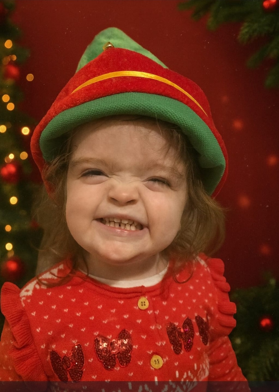 £50,000 Needed for Matilda's Cochlear Implant campaign photo, 2 of 7