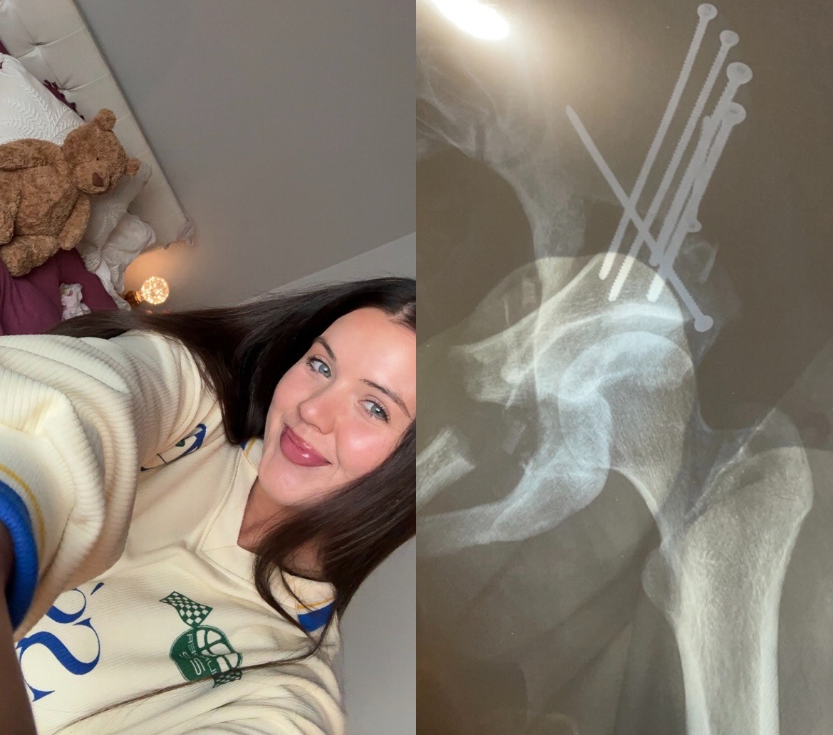 Helping our girl Soph heal campaign photo, 2 of 4
