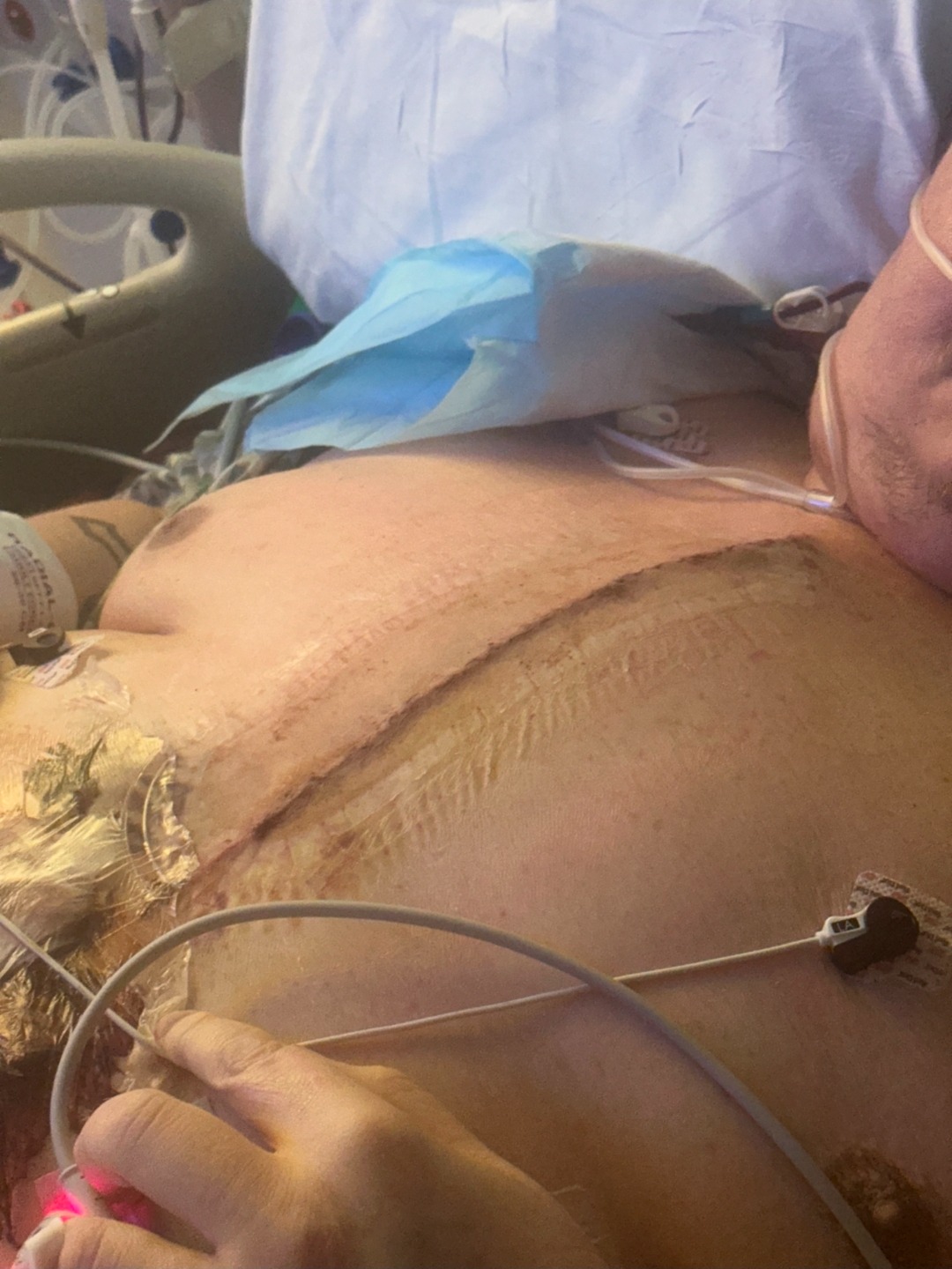 Help Wally Get threw Life-Saving Heart Surgery campaign photo, 4 of 7