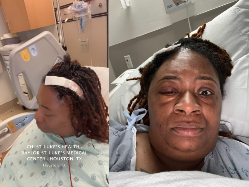 Aid Keshea's Journey Through Brain Tumor Treatment campaign photo, 4 of 5