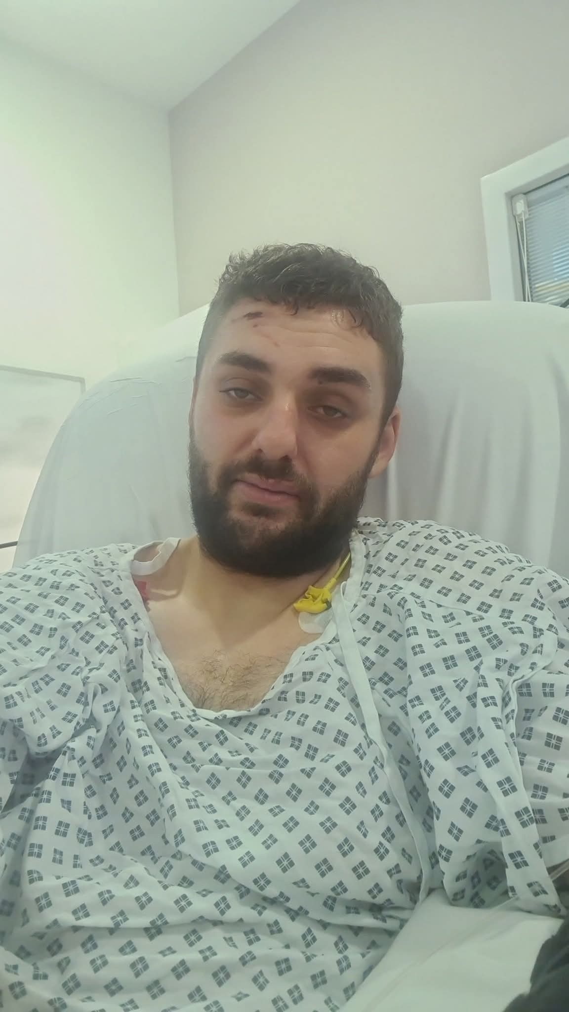 Please help Aaron after life changing motorcycle crash. campaign photo, 2 of 4