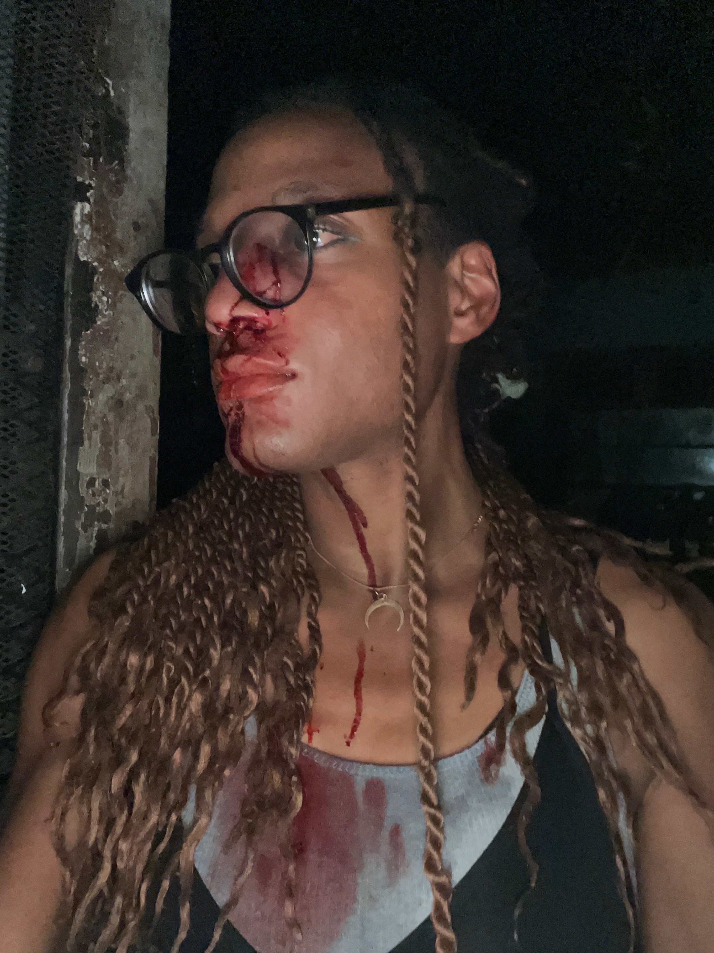 Help a Trans Woman with their Surgery & Debt campaign photo, 1 of 4