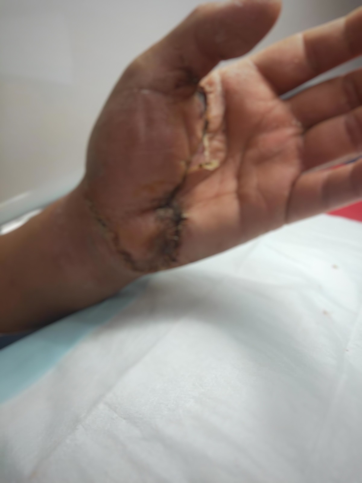 Emergency support for a Victim of a Targeted Attack campaign photo, 2 of 4