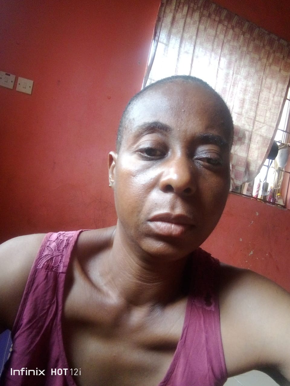 Help Ama Fight Severe Complications After Multiple Surgeries campaign photo, 2 of 7