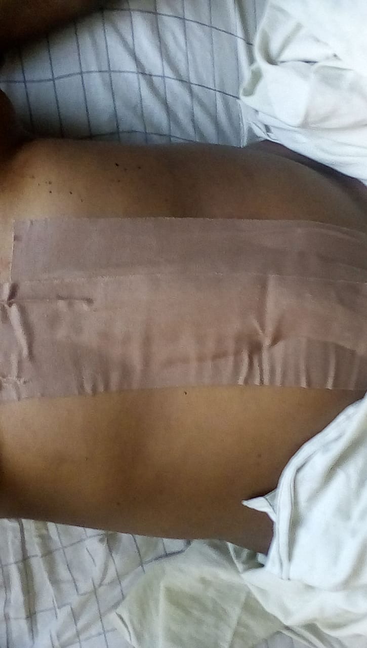 Help Ama Fight Severe Complications After Multiple Surgeries campaign photo, 4 of 7