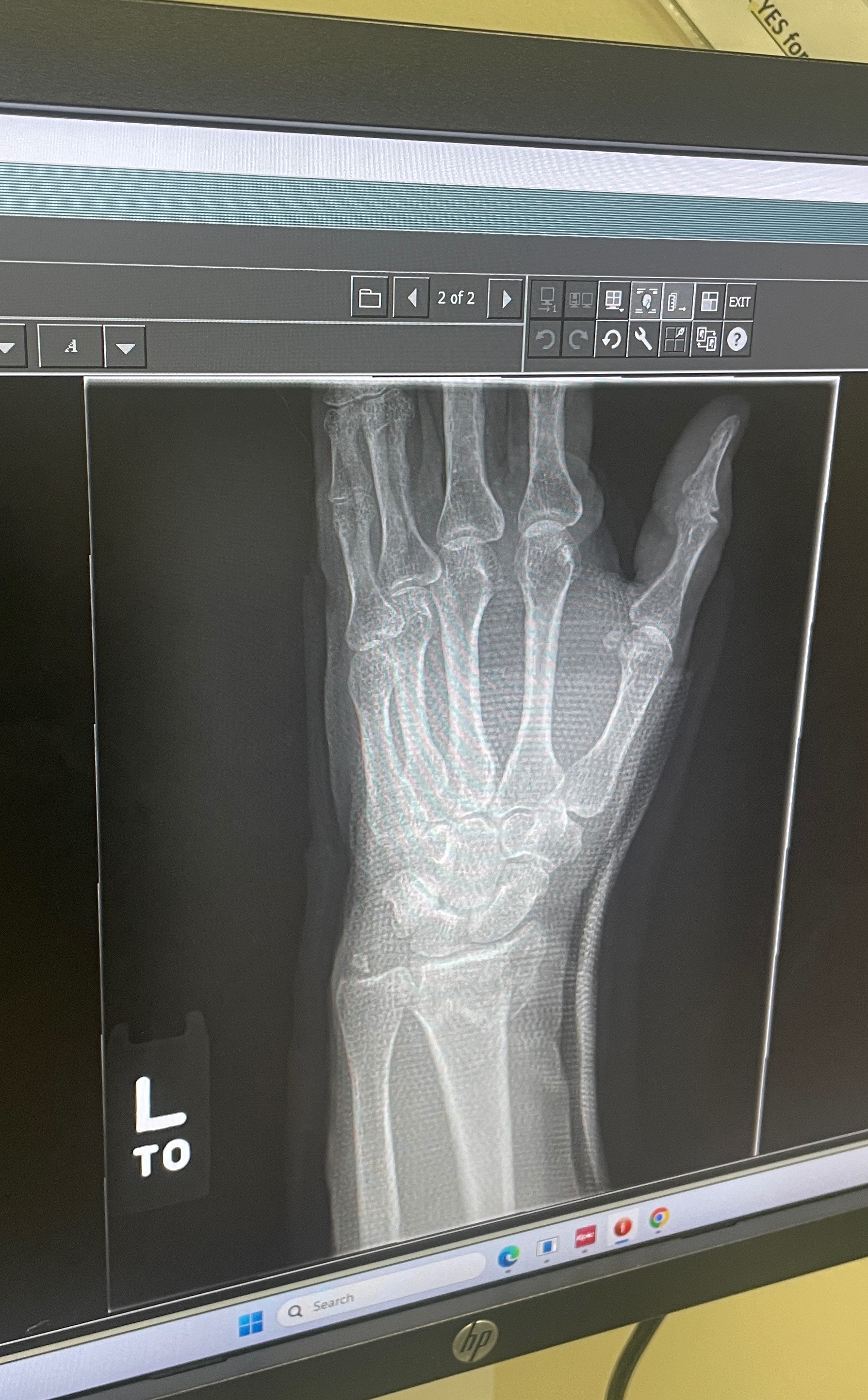 Deb Broke Her Kneecap & Wrist Doing a Kind Favor campaign photo, 4 of 7