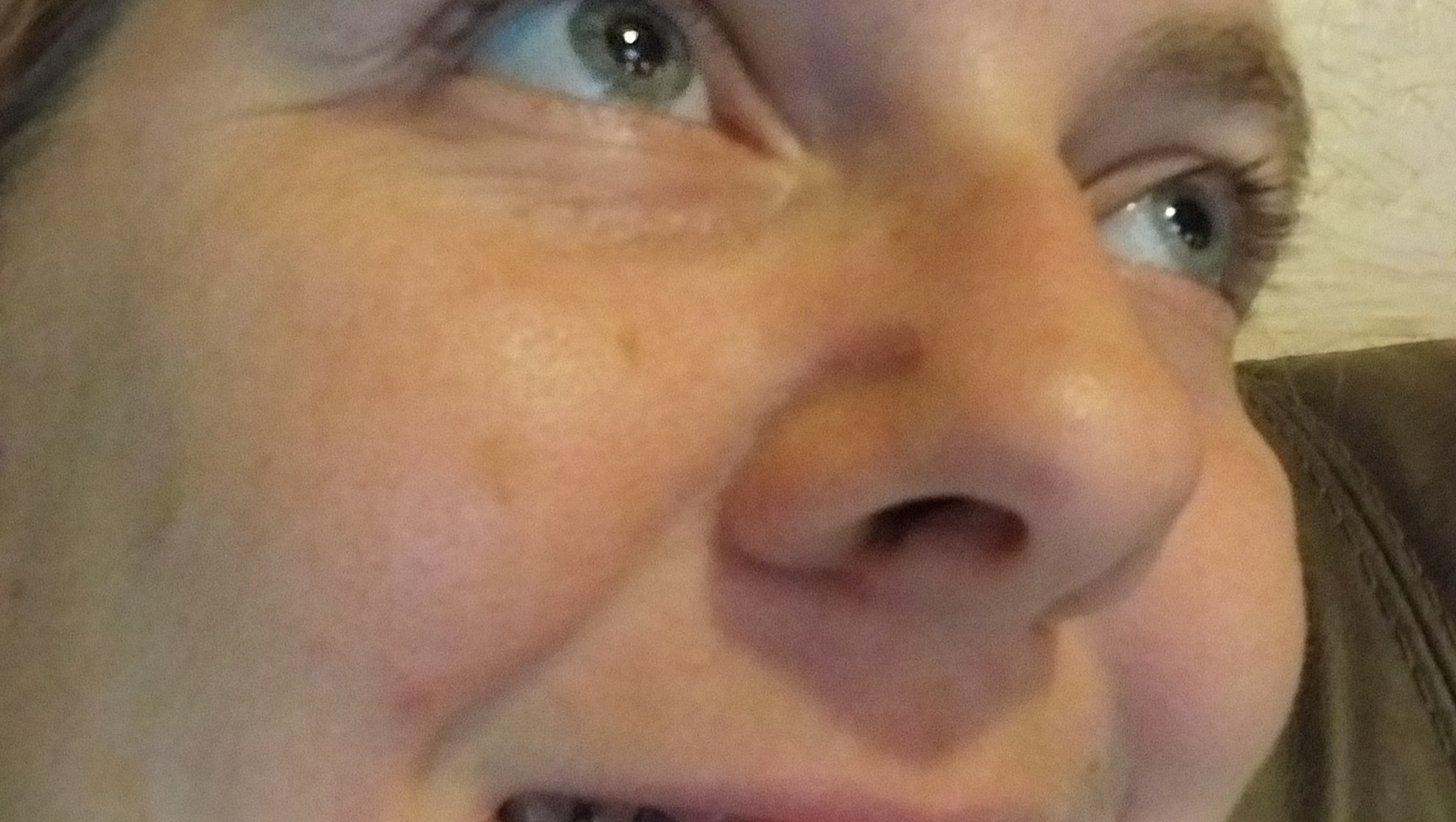 Help Me Get Life-Changing Dental Surgery photo