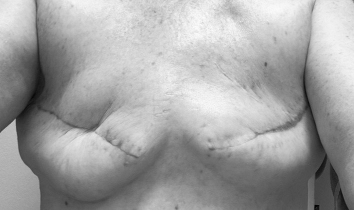 Help Heather through Revision Surgery campaign photo, 5 of 6