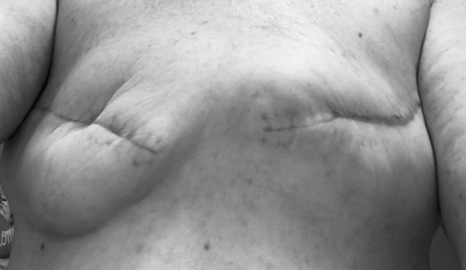 Help Heather through Revision Surgery campaign photo, 2 of 6