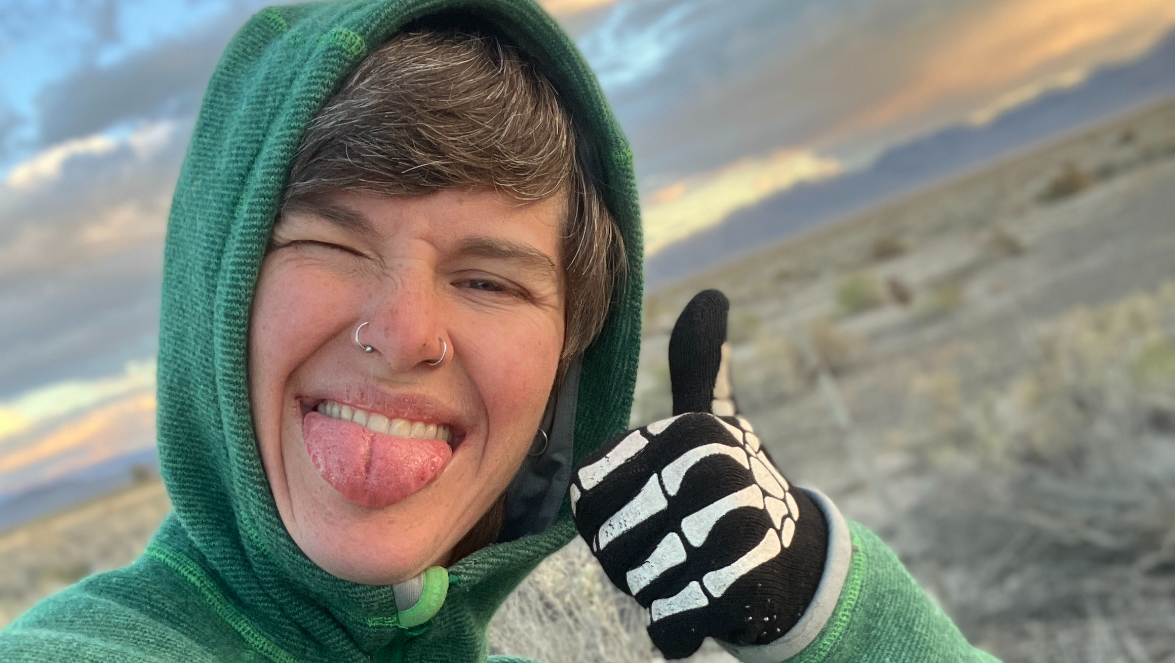 Support James’s Recovery After Horrific Hit-and-Run Accident photo