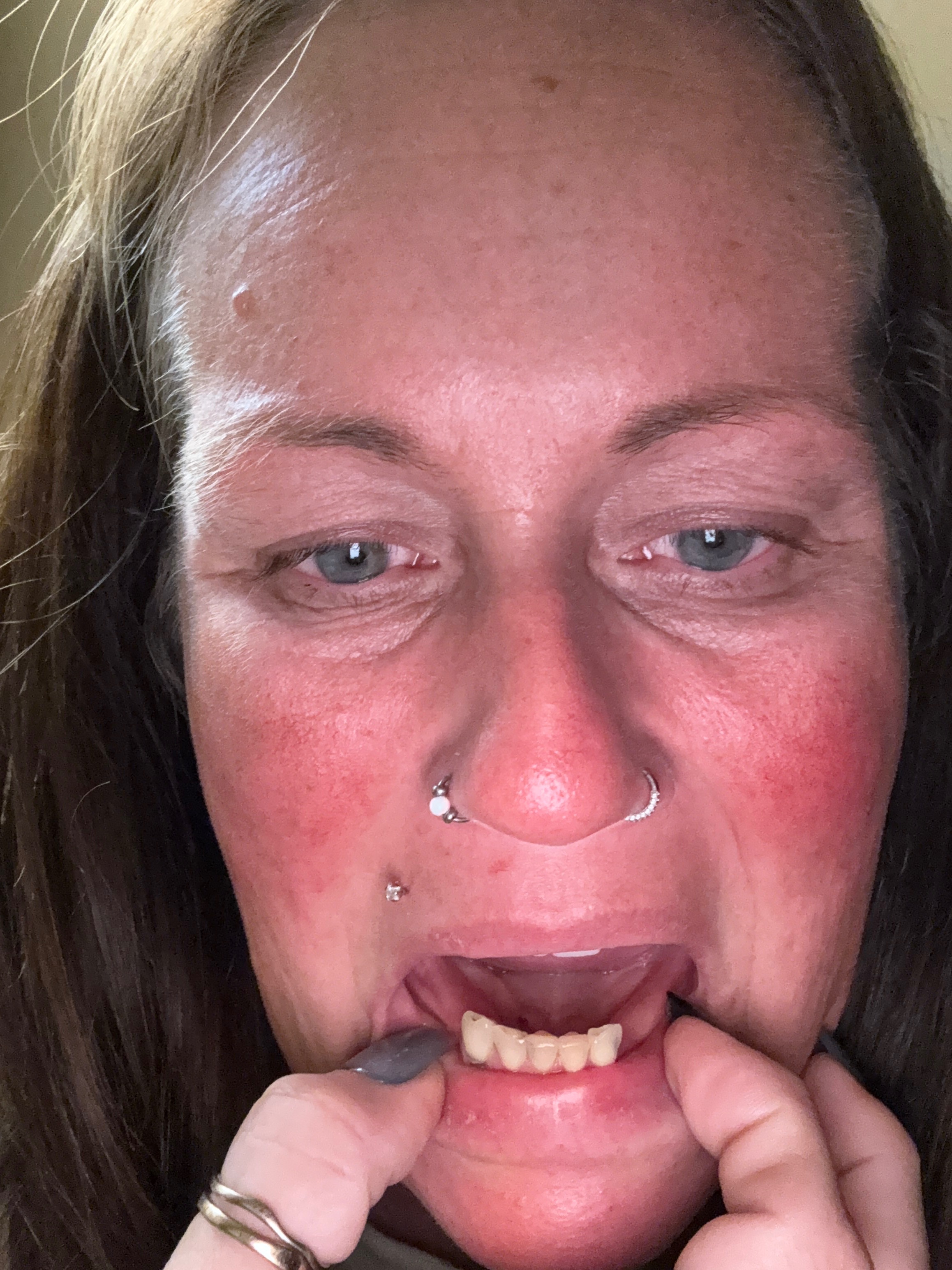 Restore Kristy's Smile and help her get out of pain campaign photo, 2 of 6