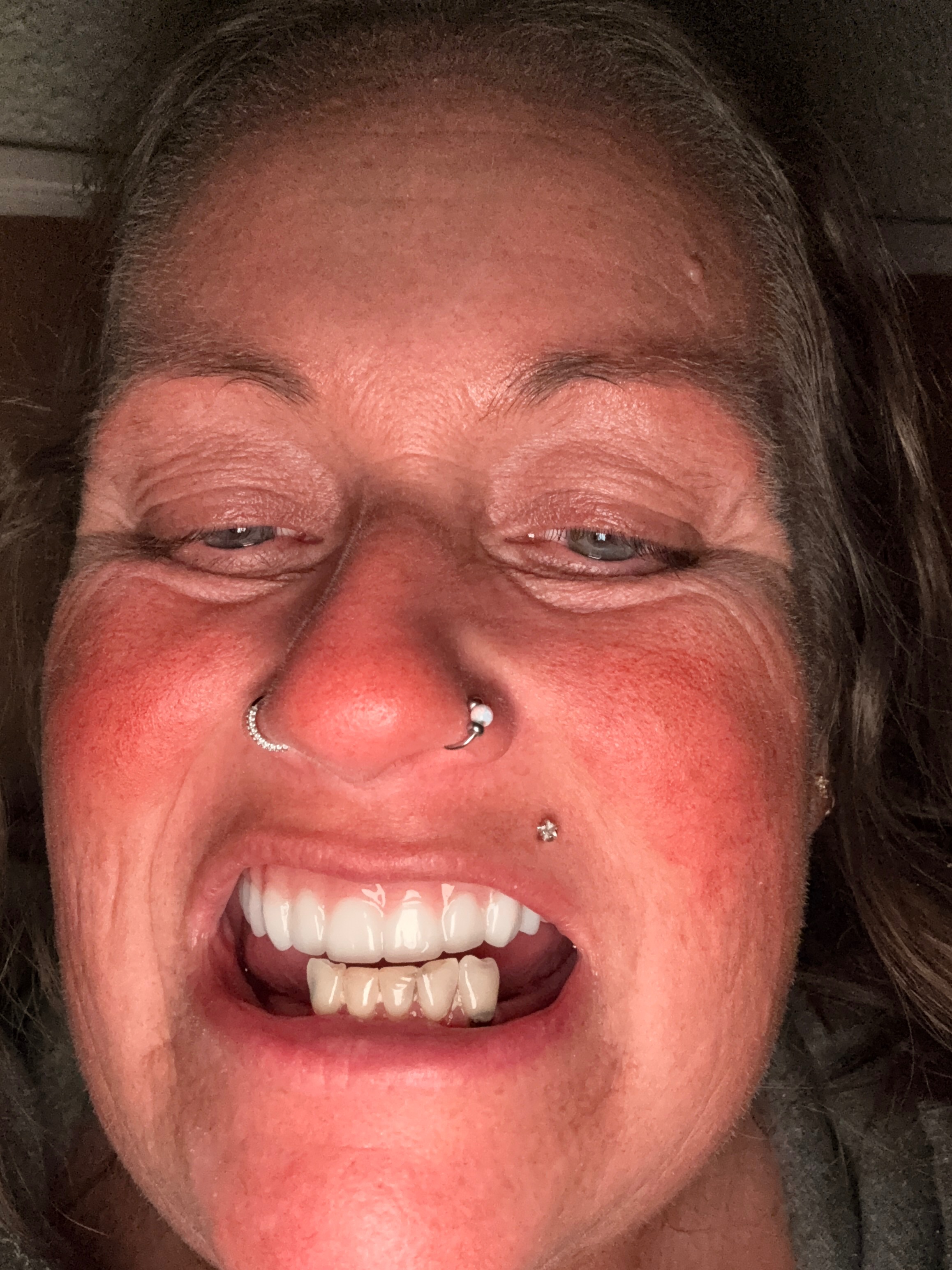 Restore Kristy's Smile and help her get out of pain campaign photo, 4 of 6