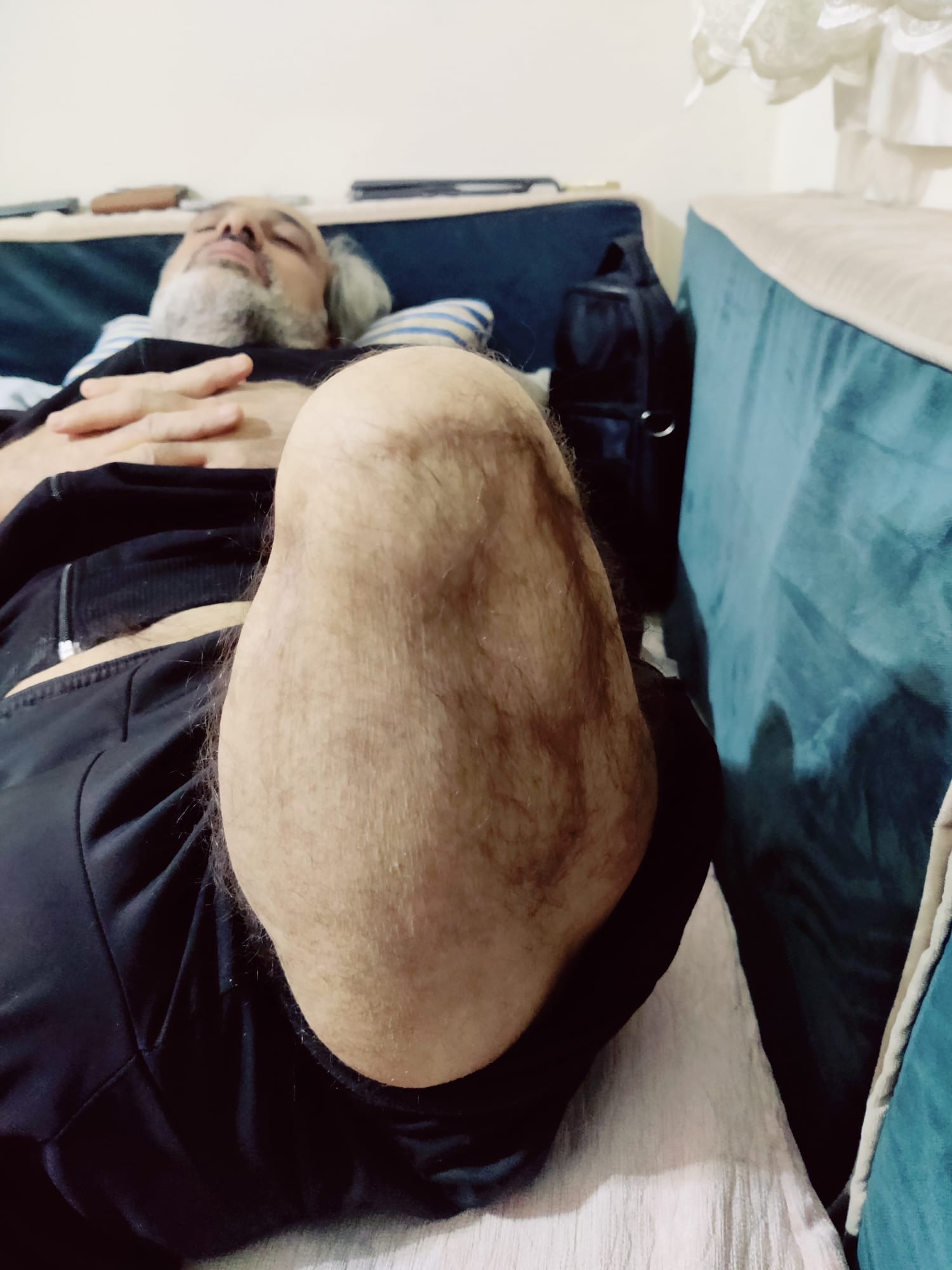 Help Osman weer op de been – letterlijk campaign photo, 2 of 8