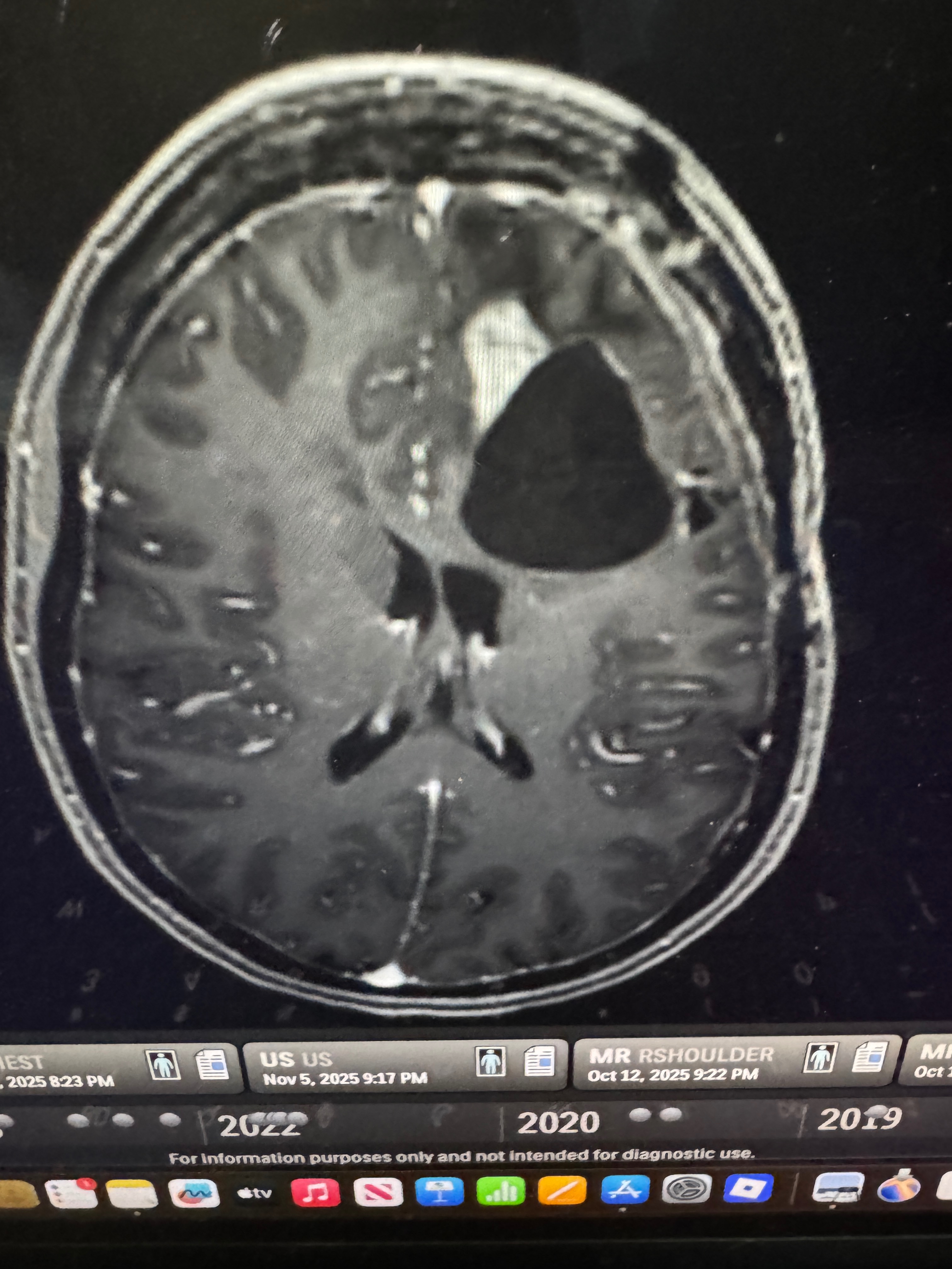Funds Needed for Brain Cancer Surgery & Travel campaign photo, 2 of 7