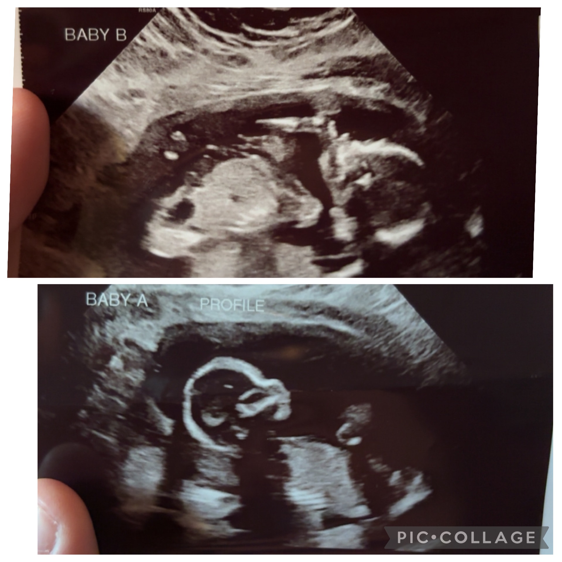 Support Josie’s Family During High-Risk Pregnancy campaign photo, 4 of 6