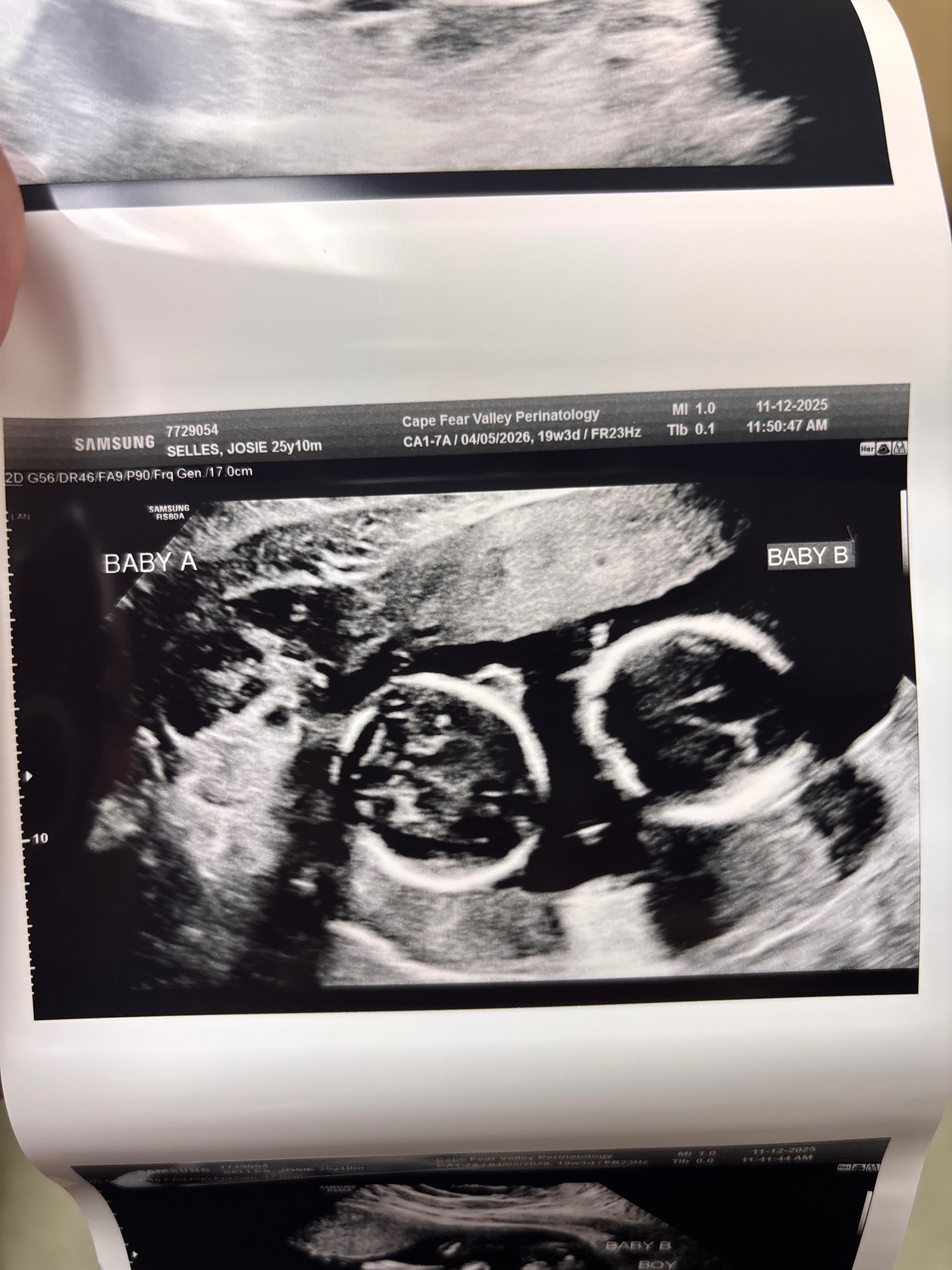 Support Josie’s Family During High-Risk Pregnancy campaign photo, 5 of 6