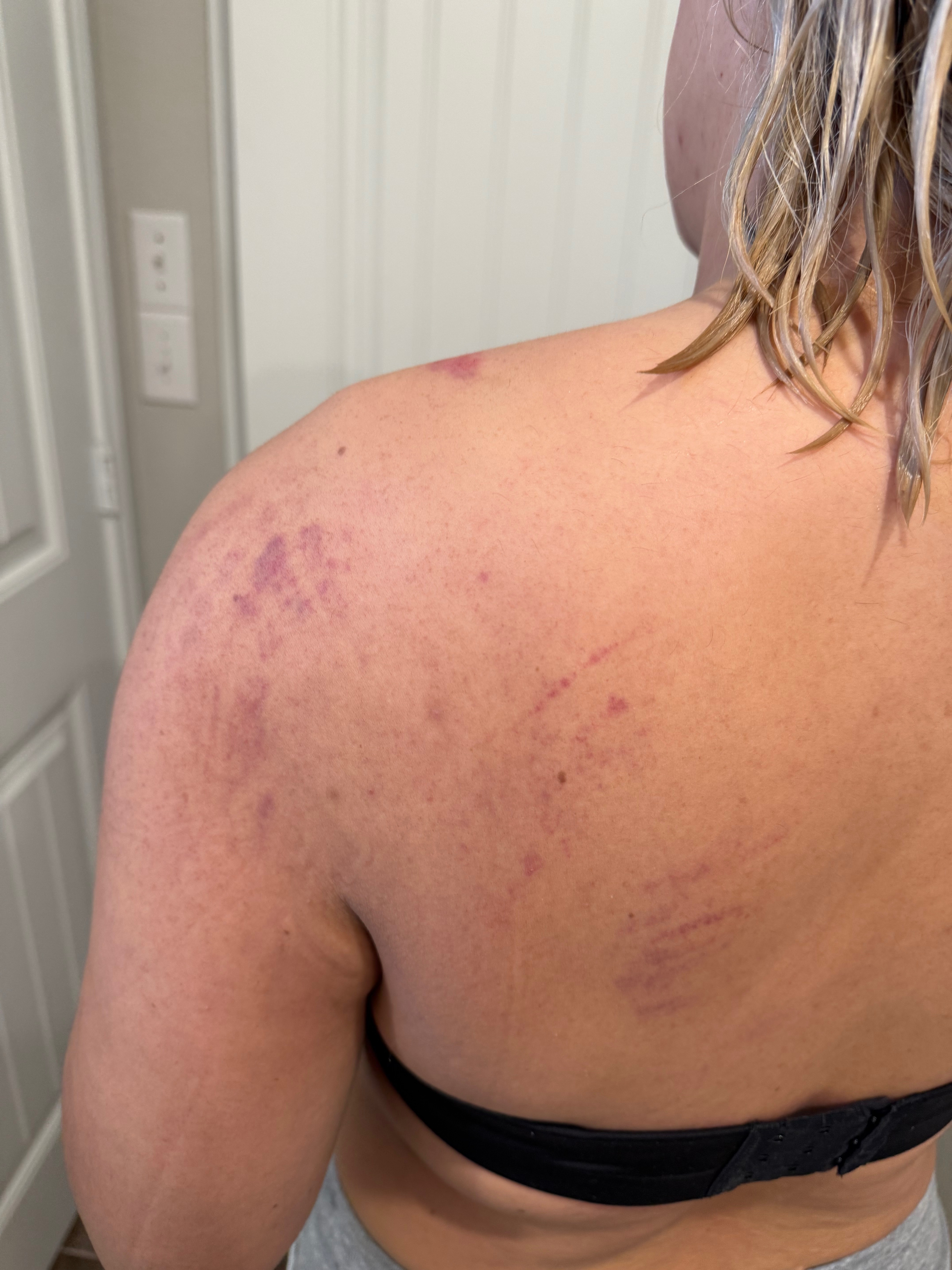Help Ana González Recover from Hit-and-Run Injury campaign photo, 4 of 5