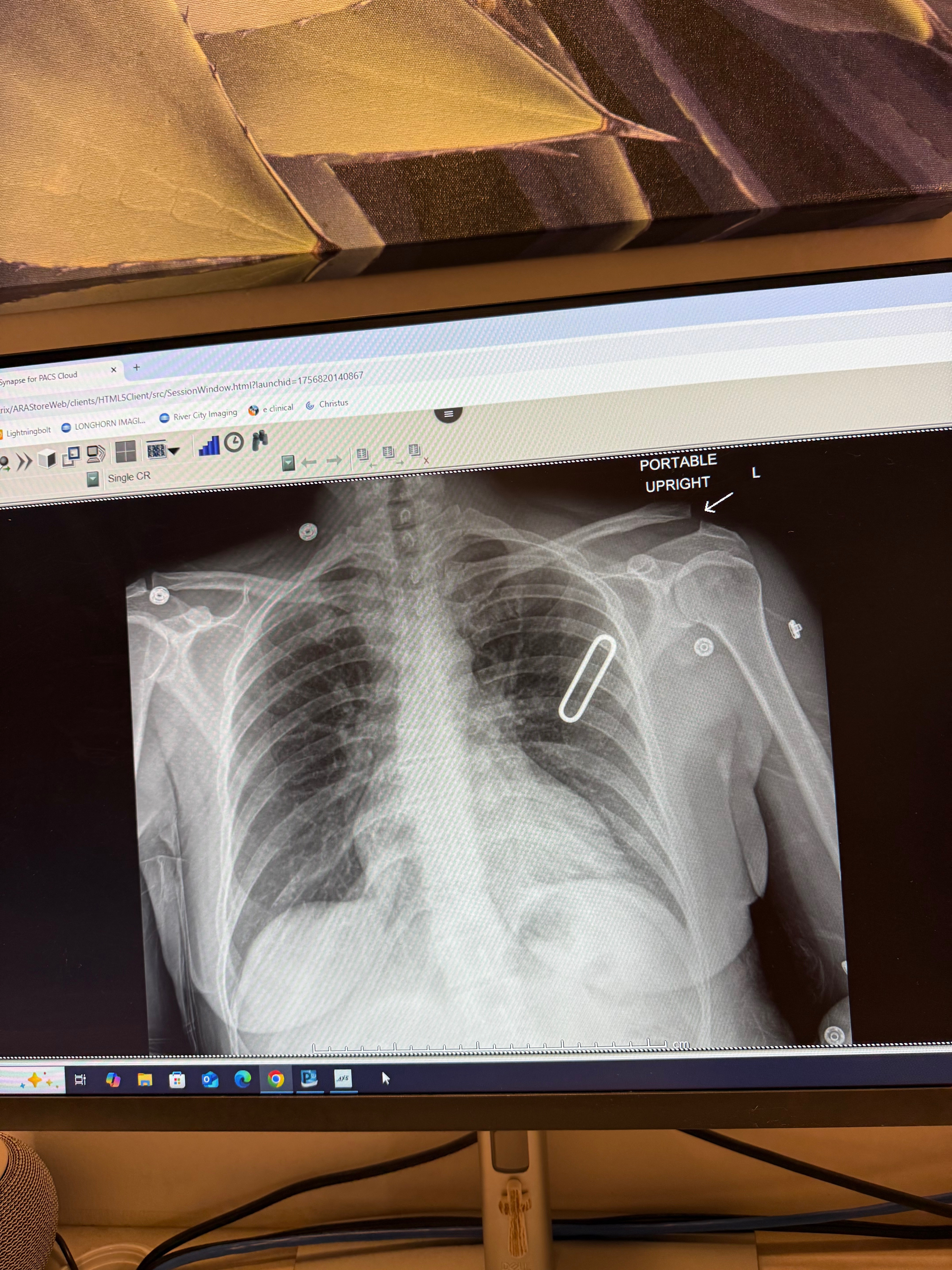 Help Ana González Recover from Hit-and-Run Injury campaign photo, 2 of 5