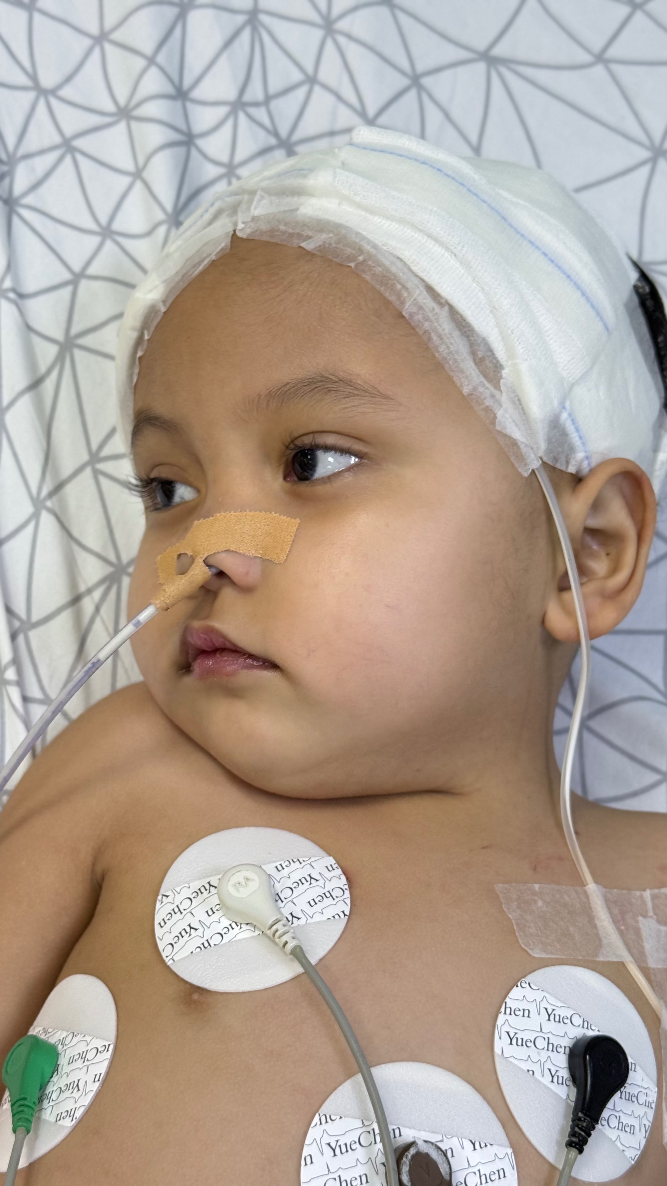For Mavi’s Recovery: After Three Life-Saving Brain Surgeries campaign photo, 2 of 5