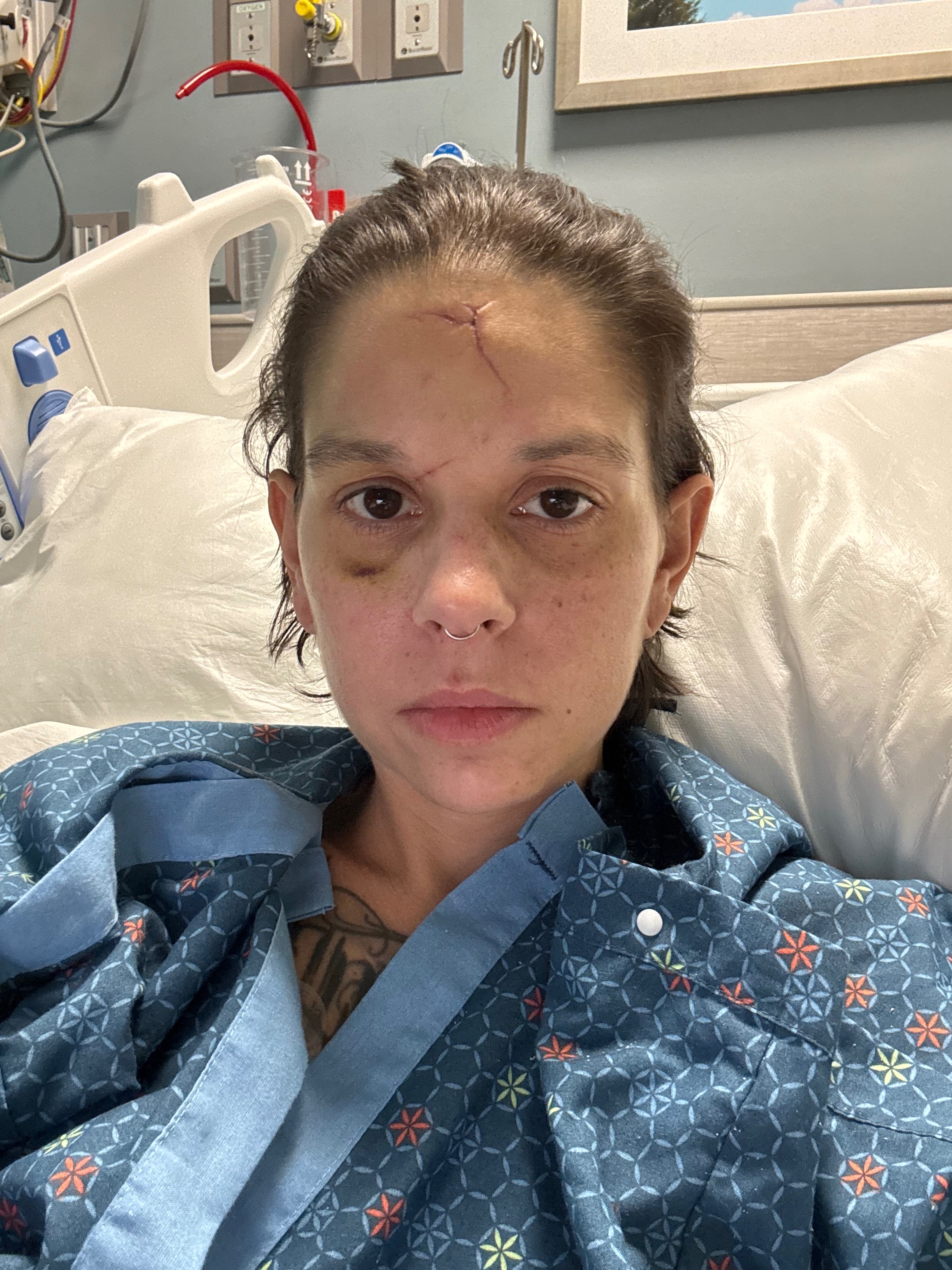 Help CJ Rebuild Life After Devastating Car Crash campaign photo, 5 of 8