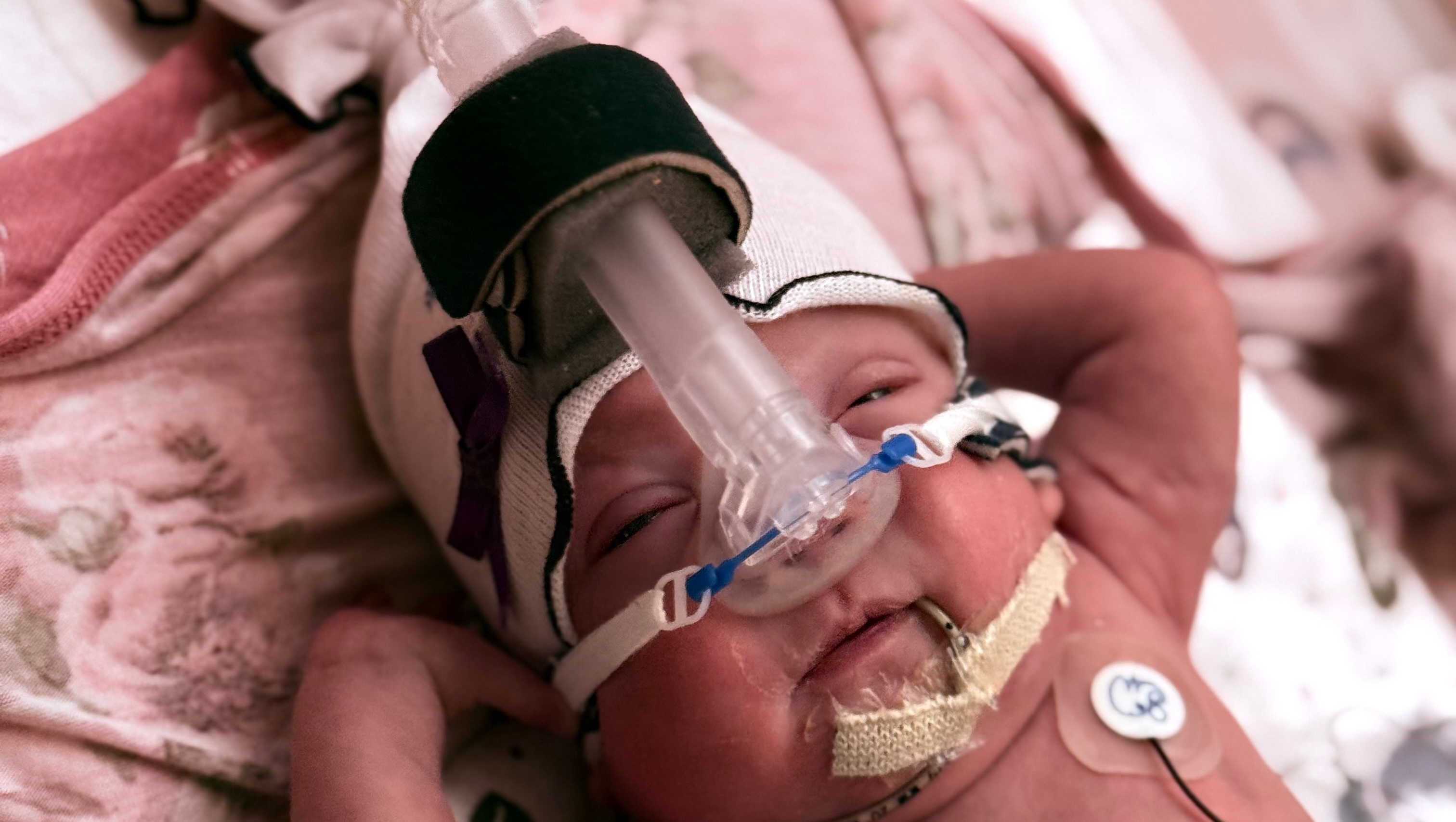 Baby Quincy’s NICU Journey from birth at 24 weeks photo