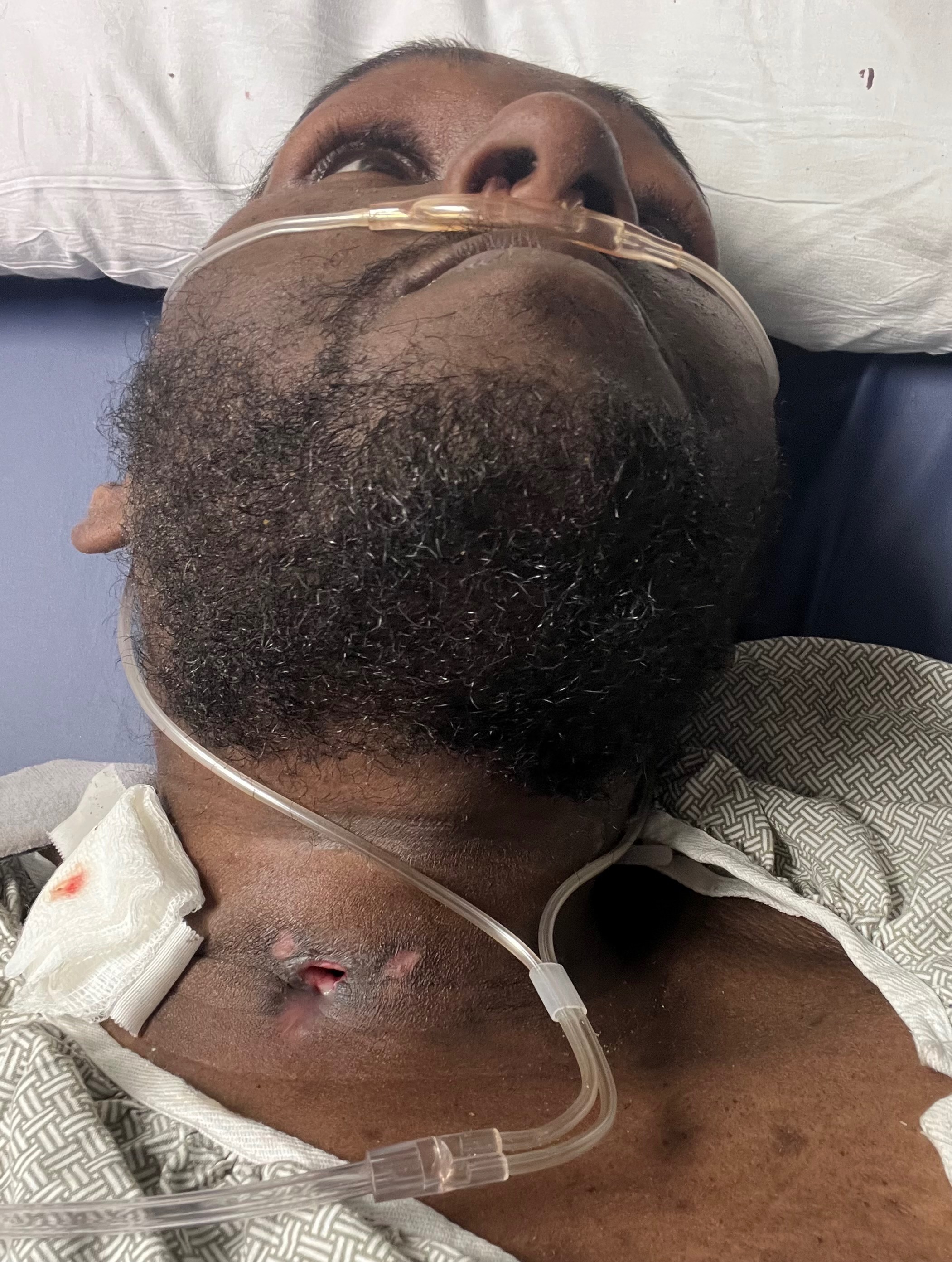 Help Shuntral Recover and Rebuild His Life campaign photo, 2 of 3