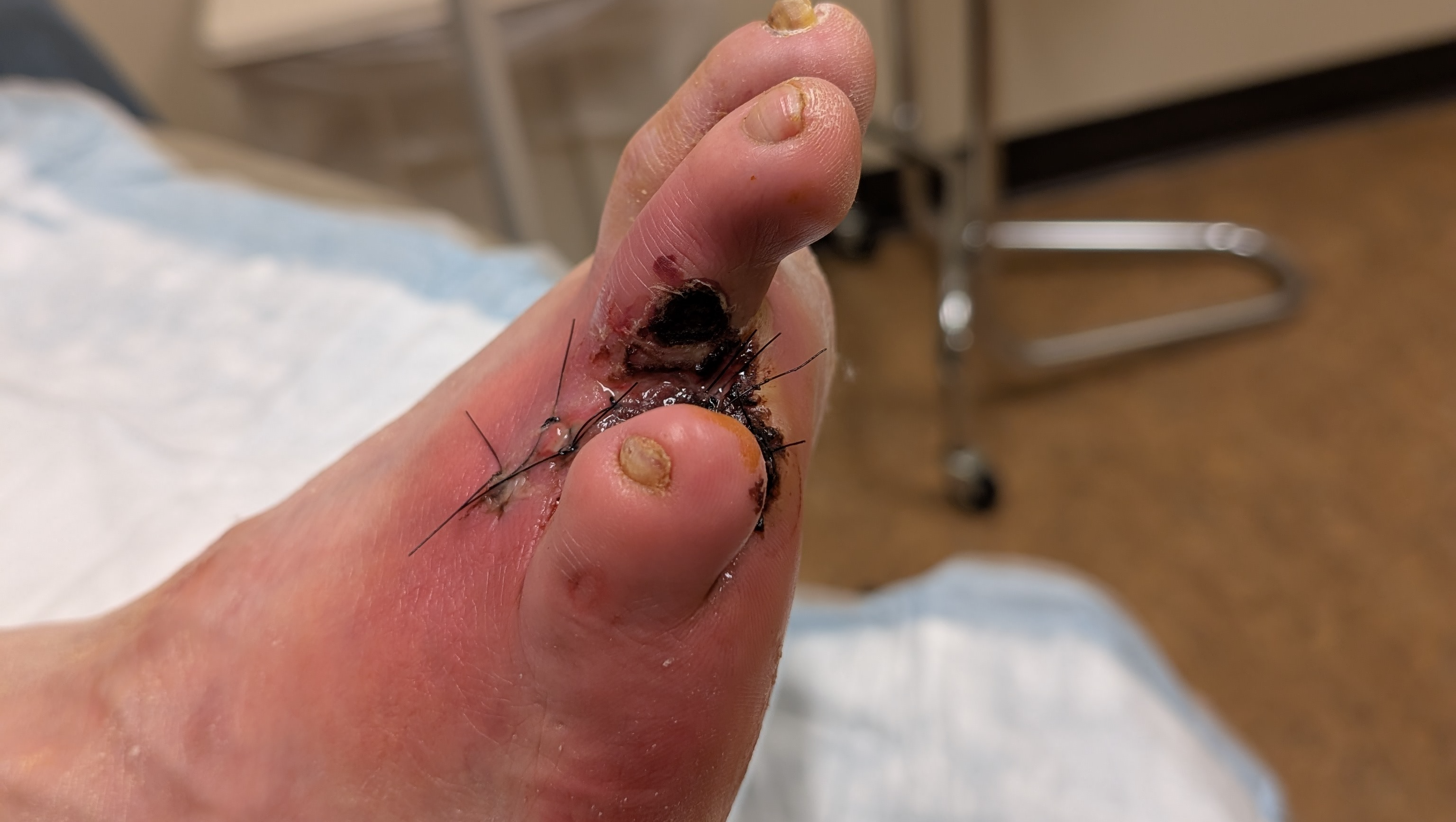 Help Mario Avoid Another Amputation photo