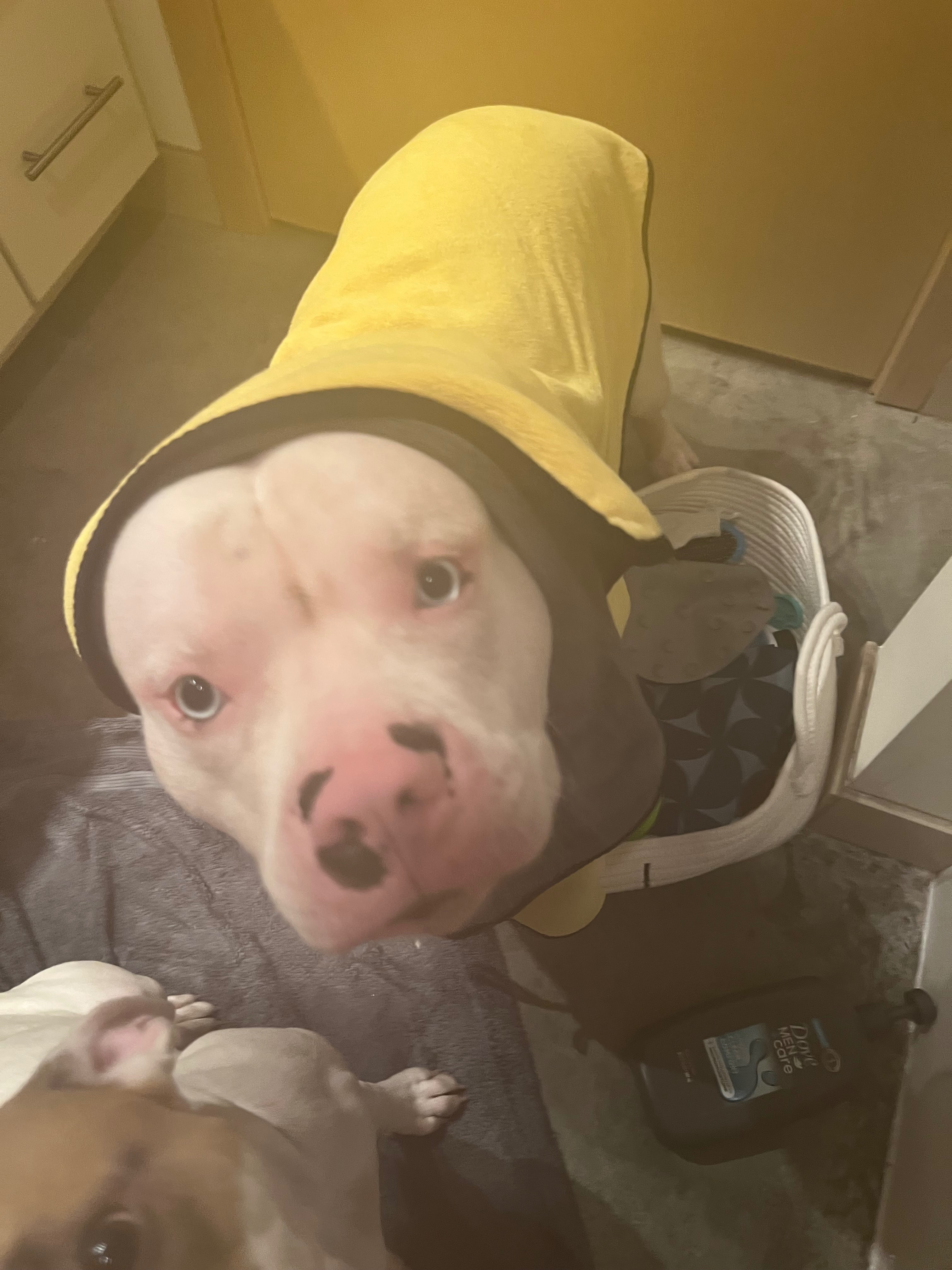 Help Tommy Get Lifesaving Surgery campaign photo, 2 of 6