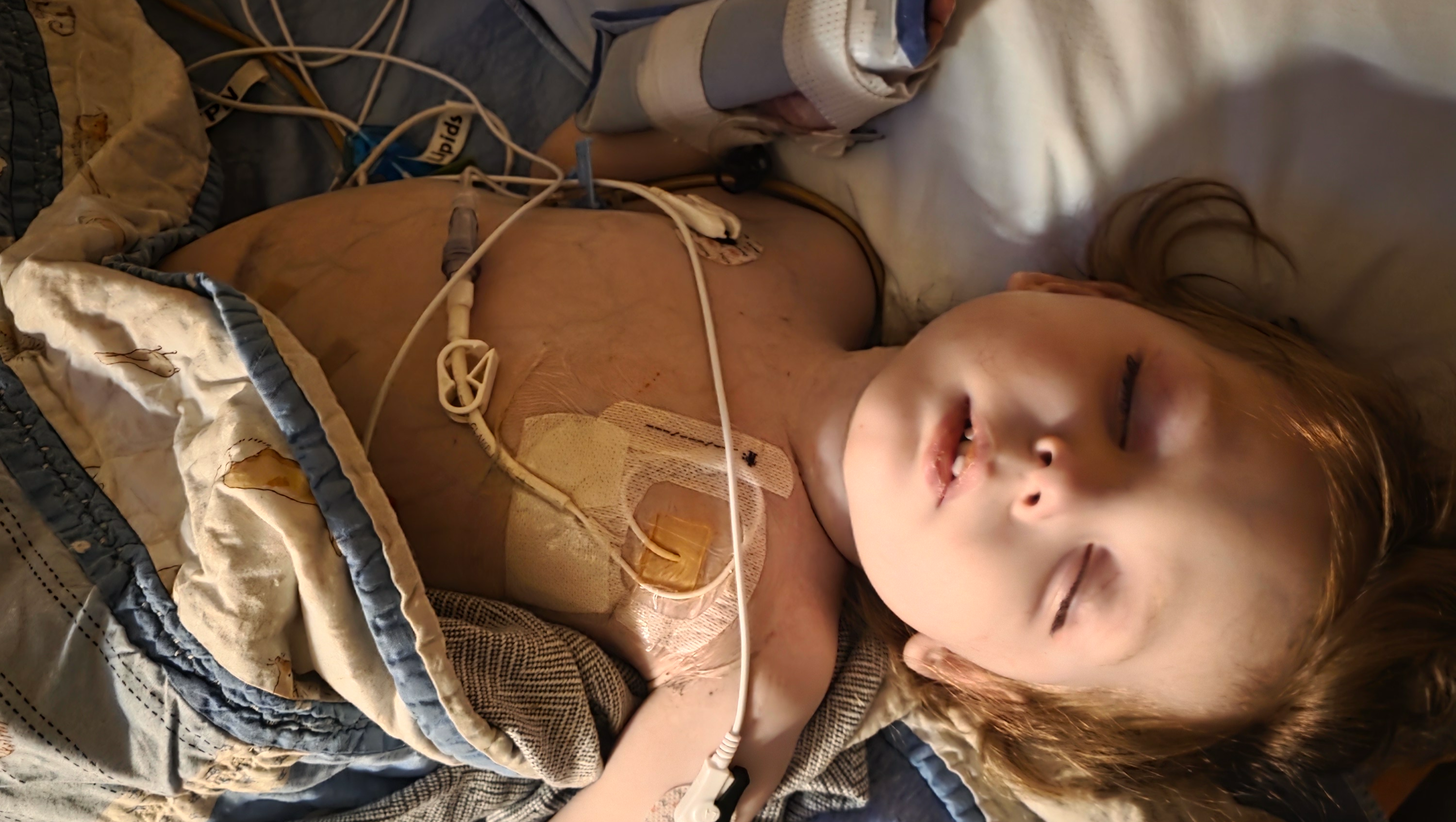 Support Kota’s Journey After Heart Surgery photo
