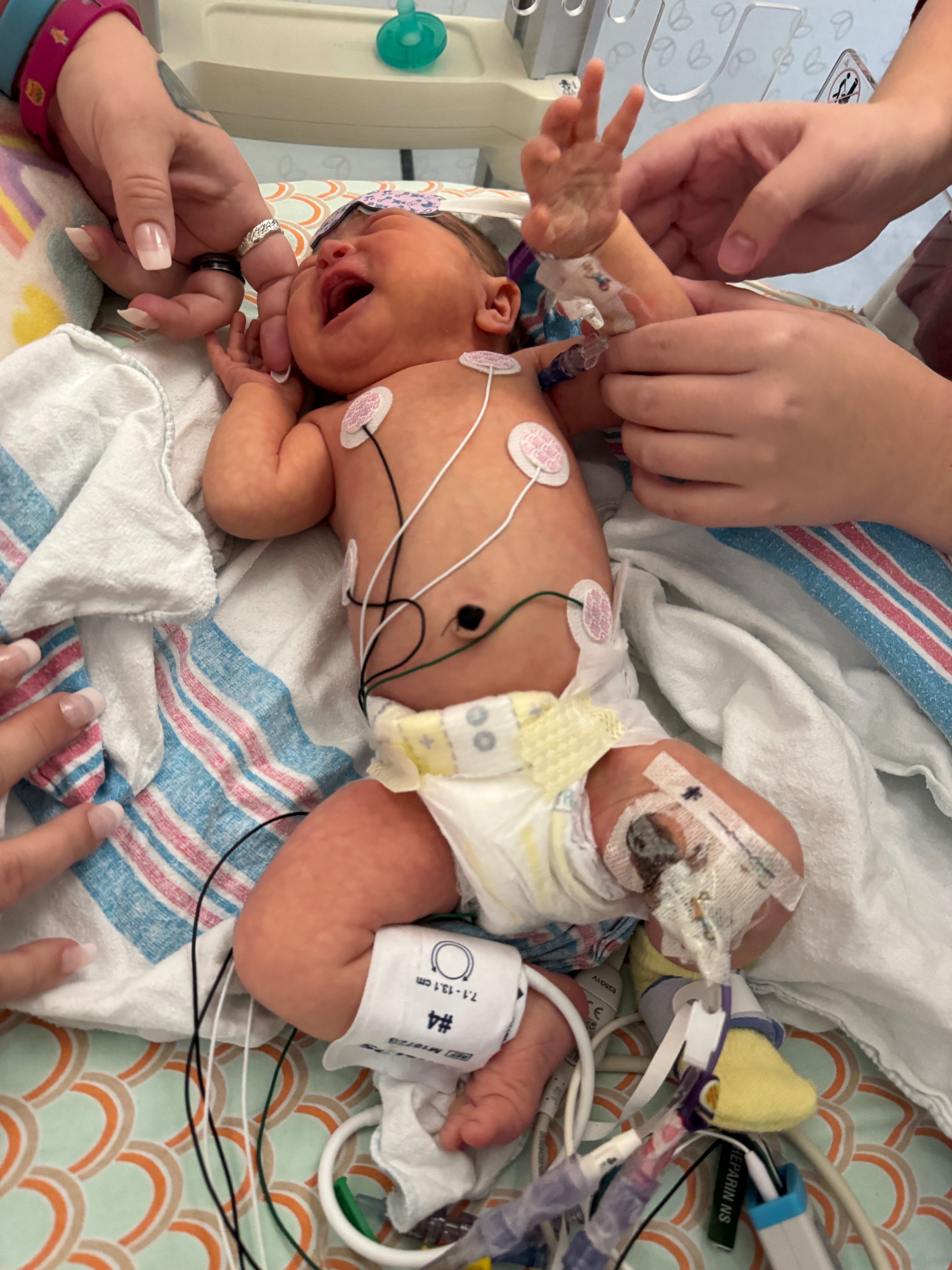 Hope and Healing for Baby Genevieve in Cardiac ICU campaign photo, 6 of 8