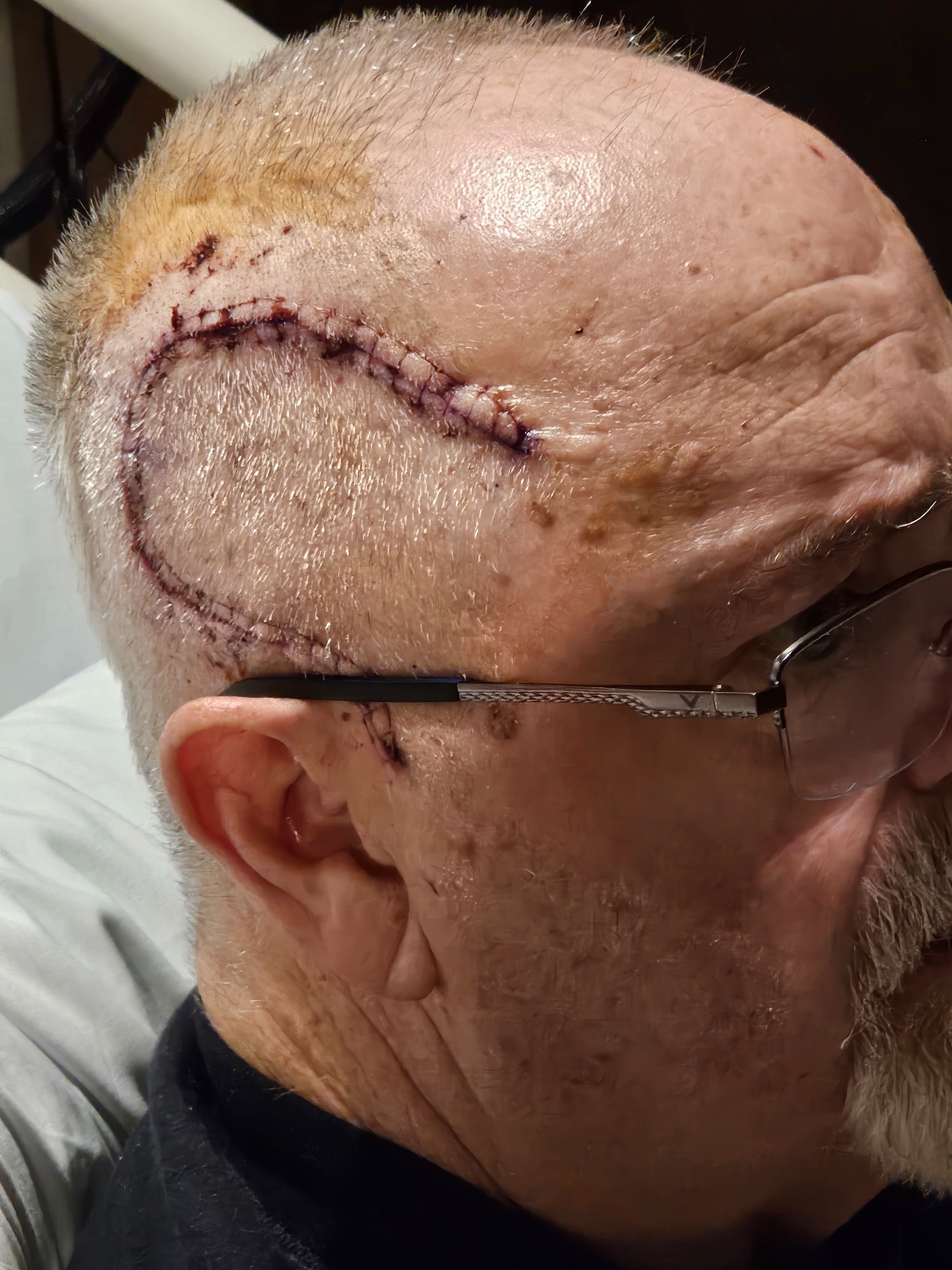 Support Ed & Marlea Through Ed's Brain Cancer campaign photo, 5 of 7